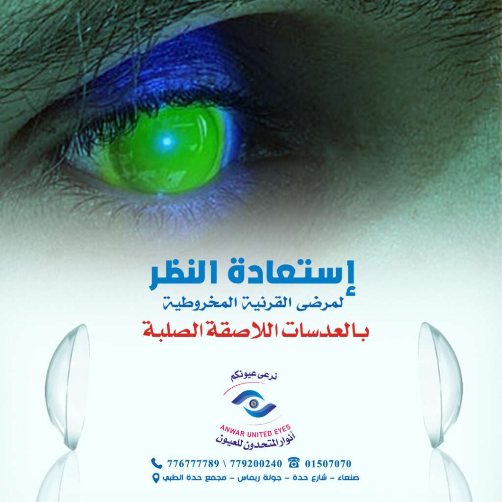 علاج القرنية المخروطية في صنعاء ، اليمن زراعة العدسات للقرنية المخروطية في صنعاء ، اليمن سعر العدسات الصلبة للقرنية المخروطية في صنعاء ، اليمن تكلفة العدسات الصلبة للقرنية المخروطية في صنعاء ، اليمن زراعة العدسات الصلبة للقرنية في صنعاء ، اليمن أفضل دكتور قرنية في صنعاء ، اليمن علاج القرنية المخروطية في صنعاء ، اليمن زراعة العدسات للقرنية المخروطية في صنعاء ، اليمن سعر العدسات الصلبة للقرنية المخروطية في صنعاء ، اليمن تكلفة العدسات الصلبة للقرنية المخروطية في صنعاء ، اليمن زراعة العدسات الصلبة للقرنية في صنعاء ، اليمن أفضل دكتور قرنية في صنعاء ، اليمن علاج القرنية المخروطية في صنعاء ، اليمن زراعة العدسات للقرنية المخروطية في صنعاء ، اليمن سعر العدسات الصلبة للقرنية المخروطية في صنعاء ، اليمن تكلفة العدسات الصلبة للقرنية المخروطية في صنعاء ، اليمن زراعة العدسات الصلبة للقرنية في صنعاء ، اليمن أفضل دكتور قرنية في صنعاء ، اليمن علاج القرنية المخروطية في صنعاء ، اليمن زراعة العدسات للقرنية المخروطية في صنعاء ، اليمن سعر العدسات الصلبة للقرنية المخروطية في صنعاء ، اليمن تكلفة العدسات الصلبة للقرنية المخروطية في صنعاء ، اليمن زراعة العدسات الصلبة للقرنية في صنعاء ، اليمن أفضل دكتور قرنية في صنعاء ، اليمن علاج القرنية المخروطية في صنعاء ، اليمن زراعة العدسات للقرنية المخروطية في صنعاء ، اليمن سعر العدسات الصلبة للقرنية المخروطية في صنعاء ، اليمن تكلفة العدسات الصلبة للقرنية المخروطية في صنعاء ، اليمن زراعة العدسات الصلبة للقرنية في صنعاء ، اليمن أفضل دكتور قرنية في صنعاء ، اليمن علاج القرنية المخروطية في صنعاء ، اليمن زراعة العدسات للقرنية المخروطية في صنعاء ، اليمن سعر العدسات الصلبة للقرنية المخروطية في صنعاء ، اليمن تكلفة العدسات الصلبة للقرنية المخروطية في صنعاء ، اليمن زراعة العدسات الصلبة للقرنية في صنعاء ، اليمن أفضل دكتور قرنية في صنعاء ، اليمن علاج القرنية المخروطية في صنعاء ، اليمن زراعة العدسات للقرنية المخروطية في صنعاء ، اليمن سعر العدسات الصلبة للقرنية المخروطية في صنعاء ، اليمن تكلفة العدسات الصلبة للقرنية المخروطية في صنعاء ، اليمن زراعة العدسات الصلبة للقرنية في صنعاء ، اليمن أفضل دكتور قرنية في صنعاء ، اليمن علاج القرنية المخروطية في صنعاء ، اليمن زراعة العدسات للقرنية المخروطية في صنعاء ، اليمن سعر العدسات الصلبة للقرنية المخروطية في صنعاء ، اليمن تكلفة العدسات الصلبة للقرنية المخروطية في صنعاء ، اليمن زراعة العدسات الصلبة للقرنية في صنعاء ، اليمن أفضل دكتور قرنية في صنعاء ، اليمن علاج القرنية المخروطية في صنعاء ، اليمن زراعة العدسات للقرنية المخروطية في صنعاء ، اليمن سعر العدسات الصلبة للقرنية المخروطية في صنعاء ، اليمن تكلفة العدسات الصلبة للقرنية المخروطية في صنعاء ، اليمن زراعة العدسات الصلبة للقرنية في صنعاء ، اليمن أفضل دكتور قرنية في صنعاء ، اليمن علاج القرنية المخروطية في صنعاء ، اليمن زراعة العدسات للقرنية المخروطية في صنعاء ، اليمن سعر العدسات الصلبة للقرنية المخروطية في صنعاء ، اليمن تكلفة العدسات الصلبة للقرنية المخروطية في صنعاء ، اليمن زراعة العدسات الصلبة للقرنية في صنعاء ، اليمن أفضل دكتور قرنية في صنعاء ، اليمن علاج القرنية المخروطية في صنعاء ، اليمن زراعة العدسات للقرنية المخروطية في صنعاء ، اليمن سعر العدسات الصلبة للقرنية المخروطية في صنعاء ، اليمن تكلفة العدسات الصلبة للقرنية المخروطية في صنعاء ، اليمن زراعة العدسات الصلبة للقرنية في صنعاء ، اليمن أفضل دكتور قرنية في صنعاء ، اليمن علاج القرنية المخروطية في صنعاء ، اليمن زراعة العدسات للقرنية المخروطية في صنعاء ، اليمن سعر العدسات الصلبة للقرنية المخروطية في صنعاء ، اليمن تكلفة العدسات الصلبة للقرنية المخروطية في صنعاء ، اليمن زراعة العدسات الصلبة للقرنية في صنعاء ، اليمن أفضل دكتور قرنية في صنعاء ، اليمن علاج القرنية المخروطية في صنعاء ، اليمن زراعة العدسات للقرنية المخروطية في صنعاء ، اليمن سعر العدسات الصلبة للقرنية المخروطية في صنعاء ، اليمن تكلفة العدسات الصلبة للقرنية المخروطية في صنعاء ، اليمن زراعة العدسات الصلبة للقرنية في صنعاء ، اليمن أفضل دكتور قرنية في صنعاء ، اليمن علاج القرنية المخروطية في صنعاء ، اليمن زراعة العدسات للقرنية المخروطية في صنعاء ، اليمن سعر العدسات الصلبة للقرنية المخروطية في صنعاء ، اليمن تكلفة العدسات الصلبة للقرنية المخروطية في صنعاء ، اليمن زراعة العدسات الصلبة للقرنية في صنعاء ، اليمن أفضل دكتور قرنية في صنعاء ، اليمن علاج القرنية المخروطية في صنعاء ، اليمن زراعة العدسات للقرنية المخروطية في صنعاء ، اليمن سعر العدسات الصلبة للقرنية المخروطية في صنعاء ، اليمن تكلفة العدسات الصلبة للقرنية المخروطية في صنعاء ، اليمن زراعة العدسات الصلبة للقرنية في صنعاء ، اليمن أفضل دكتور قرنية في صنعاء ، اليمن علاج القرنية المخروطية في صنعاء ، اليمن زراعة العدسات للقرنية المخروطية في صنعاء ، اليمن سعر العدسات الصلبة للقرنية المخروطية في صنعاء ، اليمن تكلفة العدسات الصلبة للقرنية المخروطية في صنعاء ، اليمن زراعة العدسات الصلبة للقرنية في صنعاء ، اليمن أفضل دكتور قرنية في صنعاء ، اليمن علاج القرنية المخروطية في صنعاء ، اليمن زراعة العدسات للقرنية المخروطية في صنعاء ، اليمن سعر العدسات الصلبة للقرنية المخروطية في صنعاء ، اليمن تكلفة العدسات الصلبة للقرنية المخروطية في صنعاء ، اليمن زراعة العدسات الصلبة للقرنية في صنعاء ، اليمن أفضل دكتور قرنية في صنعاء ، اليمن علاج القرنية المخروطية في صنعاء ، اليمن زراعة العدسات للقرنية المخروطية في صنعاء ، اليمن سعر العدسات الصلبة للقرنية المخروطية في صنعاء ، اليمن تكلفة العدسات الصلبة للقرنية المخروطية في صنعاء ، اليمن زراعة العدسات الصلبة للقرنية في صنعاء ، اليمن أفضل دكتور قرنية في صنعاء ، اليمن علاج القرنية المخروطية في صنعاء ، اليمن زراعة العدسات للقرنية المخروطية في صنعاء ، اليمن سعر العدسات الصلبة للقرنية المخروطية في صنعاء ، اليمن تكلفة العدسات الصلبة للقرنية المخروطية في صنعاء ، اليمن زراعة العدسات الصلبة للقرنية في صنعاء ، اليمن أفضل دكتور قرنية في صنعاء ، اليمن علاج القرنية المخروطية في صنعاء ، اليمن زراعة العدسات للقرنية المخروطية في صنعاء ، اليمن سعر العدسات الصلبة للقرنية المخروطية في صنعاء ، اليمن تكلفة العدسات الصلبة للقرنية المخروطية في صنعاء ، اليمن زراعة العدسات الصلبة للقرنية في صنعاء ، اليمن أفضل دكتور قرنية في صنعاء ، اليمن علاج القرنية المخروطية في صنعاء ، اليمن زراعة العدسات للقرنية المخروطية في صنعاء ، اليمن سعر العدسات الصلبة للقرنية المخروطية في صنعاء ، اليمن تكلفة العدسات الصلبة للقرنية المخروطية في صنعاء ، اليمن زراعة العدسات الصلبة للقرنية في صنعاء ، اليمن أفضل دكتور قرنية في صنعاء ، اليمن علاج القرنية المخروطية في صنعاء ، اليمن زراعة العدسات للقرنية المخروطية في صنعاء ، اليمن سعر العدسات الصلبة للقرنية المخروطية في صنعاء ، اليمن تكلفة العدسات الصلبة للقرنية المخروطية في صنعاء ، اليمن زراعة العدسات الصلبة للقرنية في صنعاء ، اليمن أفضل دكتور قرنية في صنعاء ، اليمن علاج القرنية المخروطية في صنعاء ، اليمن زراعة العدسات للقرنية المخروطية في صنعاء ، اليمن سعر العدسات الصلبة للقرنية المخروطية في صنعاء ، اليمن تكلفة العدسات الصلبة للقرنية المخروطية في صنعاء ، اليمن زراعة العدسات الصلبة للقرنية في صنعاء ، اليمن أفضل دكتور قرنية في صنعاء ، اليمن علاج القرنية المخروطية في صنعاء ، اليمن زراعة العدسات للقرنية المخروطية في صنعاء ، اليمن سعر العدسات الصلبة للقرنية المخروطية في صنعاء ، اليمن تكلفة العدسات الصلبة للقرنية المخروطية في صنعاء ، اليمن زراعة العدسات الصلبة للقرنية في صنعاء ، اليمن أفضل دكتور قرنية في صنعاء ، اليمن