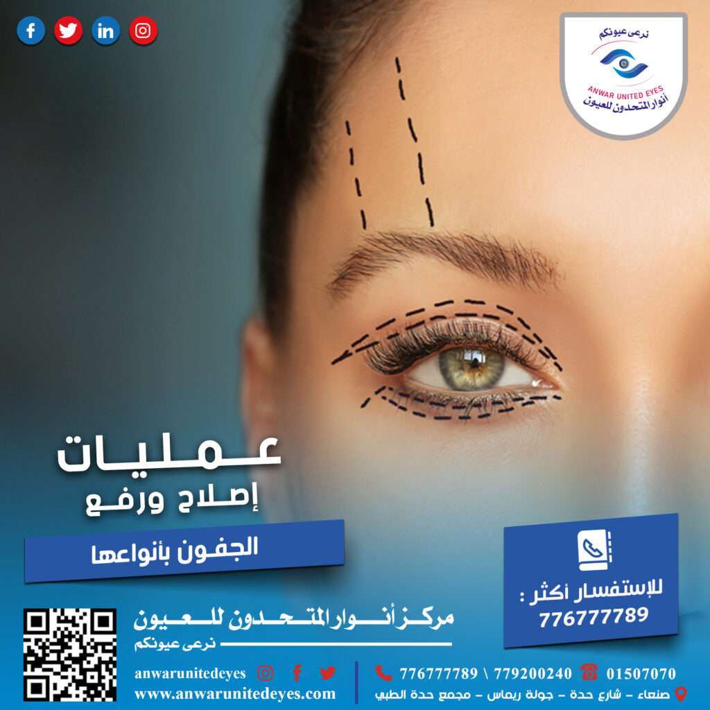 عملية شد الجفون في صنعاء ، اليمنعملية شد الجفون في صنعاء ، اليمنعملية شد الجفون في صنعاء ، اليمنعملية شد الجفون في صنعاء ، اليمنعملية شد الجفون في صنعاء ، اليمنعملية شد الجفون في صنعاء ، اليمنعملية شد الجفون في صنعاء ، اليمنعملية شد الجفون في صنعاء ، اليمنعملية شد الجفون في صنعاء ، اليمنعملية شد الجفون في صنعاء ، اليمنعملية شد الجفون في صنعاء ، اليمنعملية شد الجفون في صنعاء ، اليمنعملية شد الجفون في صنعاء ، اليمنعملية شد الجفون في صنعاء ، اليمنعملية شد الجفون في صنعاء ، اليمنعملية شد الجفون في صنعاء ، اليمنعملية شد الجفون في صنعاء ، اليمنعملية شد الجفون في صنعاء ، اليمنعملية شد الجفون في صنعاء ، اليمنعملية شد الجفون في صنعاء ، اليمنعملية شد الجفون في صنعاء ، اليمنعملية شد الجفون في صنعاء ، اليمنعملية شد الجفون في صنعاء ، اليمنعملية شد الجفون في صنعاء ، اليمنعملية شد الجفون في صنعاء ، اليمنعملية شد الجفون في صنعاء ، اليمنعملية شد الجفون في صنعاء ، اليمنعملية شد الجفون في صنعاء ، اليمنعملية شد الجفون في صنعاء ، اليمنعملية شد الجفون في صنعاء ، اليمنعملية شد الجفون في صنعاء ، اليمنعملية شد الجفون في صنعاء ، اليمنعملية شد الجفون في صنعاء ، اليمنعملية شد الجفون في صنعاء ، اليمنعملية شد الجفون في صنعاء ، اليمنعملية شد الجفون في صنعاء ، اليمنعملية شد الجفون في صنعاء ، اليمن