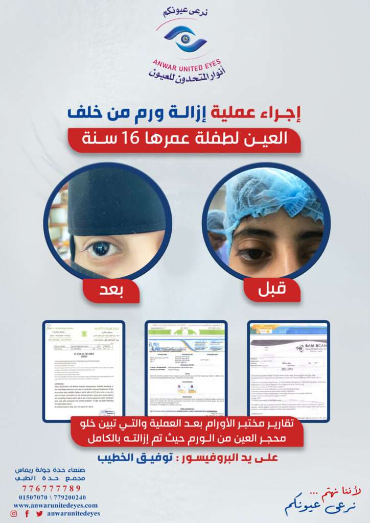 إستئصال أورام العيون في اليمن ، صنعاء جراحة أورام العيون في اليمن ، صنعاء سعر عملية أورام العيون في اليمن ، صنعاء أفضل جراح أورام عيون في اليمن ، صنعاء