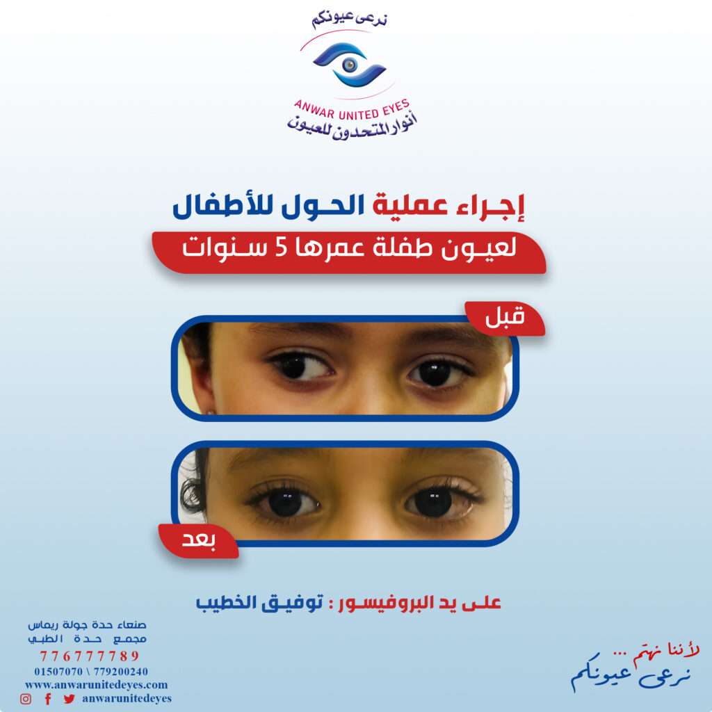 سعر عملية الحول في صنعاء ، اليمن تكلفة عملية الحول في صنعاء ، اليمن سعر عملية الحول للأطفال في صنعاء ، اليمن تكلفة عملية الحول للأطفال في صنعاء ، اليمن سعر عملية الحول في صنعاء ، اليمن تكلفة عملية الحول في صنعاء ، اليمن سعر عملية الحول للأطفال في صنعاء ، اليمن تكلفة عملية الحول للأطفال في صنعاء ، اليمن سعر عملية الحول في صنعاء ، اليمن تكلفة عملية الحول في صنعاء ، اليمن سعر عملية الحول للأطفال في صنعاء ، اليمن تكلفة عملية الحول للأطفال في صنعاء ، اليمن سعر عملية الحول في صنعاء ، اليمن تكلفة عملية الحول في صنعاء ، اليمن سعر عملية الحول للأطفال في صنعاء ، اليمن تكلفة عملية الحول للأطفال في صنعاء ، اليمن سعر عملية الحول في صنعاء ، اليمن تكلفة عملية الحول في صنعاء ، اليمن سعر عملية الحول للأطفال في صنعاء ، اليمن تكلفة عملية الحول للأطفال في صنعاء ، اليمن سعر عملية الحول في صنعاء ، اليمن تكلفة عملية الحول في صنعاء ، اليمن سعر عملية الحول للأطفال في صنعاء ، اليمن تكلفة عملية الحول للأطفال في صنعاء ، اليمن سعر عملية الحول في صنعاء ، اليمن تكلفة عملية الحول في صنعاء ، اليمن سعر عملية الحول للأطفال في صنعاء ، اليمن تكلفة عملية الحول للأطفال في صنعاء ، اليمن سعر عملية الحول في صنعاء ، اليمن تكلفة عملية الحول في صنعاء ، اليمن سعر عملية الحول للأطفال في صنعاء ، اليمن تكلفة عملية الحول للأطفال في صنعاء ، اليمنسعر عملية الحول في صنعاء ، اليمن تكلفة عملية الحول في صنعاء ، اليمن سعر عملية الحول للأطفال في صنعاء ، اليمن تكلفة عملية الحول للأطفال في صنعاء ، اليمن سعر عملية الحول في صنعاء ، اليمن تكلفة عملية الحول في صنعاء ، اليمن سعر عملية الحول للأطفال في صنعاء ، اليمن تكلفة عملية الحول للأطفال في صنعاء ، اليمن سعر عملية الحول في صنعاء ، اليمن تكلفة عملية الحول في صنعاء ، اليمن سعر عملية الحول للأطفال في صنعاء ، اليمن تكلفة عملية الحول للأطفال في صنعاء ، اليمن سعر عملية الحول في صنعاء ، اليمن تكلفة عملية الحول في صنعاء ، اليمن سعر عملية الحول للأطفال في صنعاء ، اليمن تكلفة عملية الحول للأطفال في صنعاء ، اليمنسعر عملية الحول في صنعاء ، اليمن تكلفة عملية الحول في صنعاء ، اليمن سعر عملية الحول للأطفال في صنعاء ، اليمن تكلفة عملية الحول للأطفال في صنعاء ، اليمن سعر عملية الحول في صنعاء ، اليمن تكلفة عملية الحول في صنعاء ، اليمن سعر عملية الحول للأطفال في صنعاء ، اليمن تكلفة عملية الحول للأطفال في صنعاء ، اليمن سعر عملية الحول في صنعاء ، اليمن تكلفة عملية الحول في صنعاء ، اليمن سعر عملية الحول للأطفال في صنعاء ، اليمن تكلفة عملية الحول للأطفال في صنعاء ، اليمن سعر عملية الحول في صنعاء ، اليمن تكلفة عملية الحول في صنعاء ، اليمن سعر عملية الحول للأطفال في صنعاء ، اليمن تكلفة عملية الحول للأطفال في صنعاء ، اليمنسعر عملية الحول في صنعاء ، اليمن تكلفة عملية الحول في صنعاء ، اليمن سعر عملية الحول للأطفال في صنعاء ، اليمن تكلفة عملية الحول للأطفال في صنعاء ، اليمن سعر عملية الحول في صنعاء ، اليمن تكلفة عملية الحول في صنعاء ، اليمن سعر عملية الحول للأطفال في صنعاء ، اليمن تكلفة عملية الحول للأطفال في صنعاء ، اليمن سعر عملية الحول في صنعاء ، اليمن تكلفة عملية الحول في صنعاء ، اليمن سعر عملية الحول للأطفال في صنعاء ، اليمن تكلفة عملية الحول للأطفال في صنعاء ، اليمن سعر عملية الحول في صنعاء ، اليمن تكلفة عملية الحول في صنعاء ، اليمن سعر عملية الحول للأطفال في صنعاء ، اليمن تكلفة عملية الحول للأطفال في صنعاء ، اليمنسعر عملية الحول في صنعاء ، اليمن تكلفة عملية الحول في صنعاء ، اليمن سعر عملية الحول للأطفال في صنعاء ، اليمن تكلفة عملية الحول للأطفال في صنعاء ، اليمن سعر عملية الحول في صنعاء ، اليمن تكلفة عملية الحول في صنعاء ، اليمن سعر عملية الحول للأطفال في صنعاء ، اليمن تكلفة عملية الحول للأطفال في صنعاء ، اليمن سعر عملية الحول في صنعاء ، اليمن تكلفة عملية الحول في صنعاء ، اليمن سعر عملية الحول للأطفال في صنعاء ، اليمن تكلفة عملية الحول للأطفال في صنعاء ، اليمن سعر عملية الحول في صنعاء ، اليمن تكلفة عملية الحول في صنعاء ، اليمن سعر عملية الحول للأطفال في صنعاء ، اليمن تكلفة عملية الحول للأطفال في صنعاء ، اليمنسعر عملية الحول في صنعاء ، اليمن تكلفة عملية الحول في صنعاء ، اليمن سعر عملية الحول للأطفال في صنعاء ، اليمن تكلفة عملية الحول للأطفال في صنعاء ، اليمن سعر عملية الحول في صنعاء ، اليمن تكلفة عملية الحول في صنعاء ، اليمن سعر عملية الحول للأطفال في صنعاء ، اليمن تكلفة عملية الحول للأطفال في صنعاء ، اليمن سعر عملية الحول في صنعاء ، اليمن تكلفة عملية الحول في صنعاء ، اليمن سعر عملية الحول للأطفال في صنعاء ، اليمن تكلفة عملية الحول للأطفال في صنعاء ، اليمن سعر عملية الحول في صنعاء ، اليمن تكلفة عملية الحول في صنعاء ، اليمن سعر عملية الحول للأطفال في صنعاء ، اليمن تكلفة عملية الحول للأطفال في صنعاء ، اليمنسعر عملية الحول في صنعاء ، اليمن تكلفة عملية الحول في صنعاء ، اليمن سعر عملية الحول للأطفال في صنعاء ، اليمن تكلفة عملية الحول للأطفال في صنعاء ، اليمن سعر عملية الحول في صنعاء ، اليمن تكلفة عملية الحول في صنعاء ، اليمن سعر عملية الحول للأطفال في صنعاء ، اليمن تكلفة عملية الحول للأطفال في صنعاء ، اليمن سعر عملية الحول في صنعاء ، اليمن تكلفة عملية الحول في صنعاء ، اليمن سعر عملية الحول للأطفال في صنعاء ، اليمن تكلفة عملية الحول للأطفال في صنعاء ، اليمن سعر عملية الحول في صنعاء ، اليمن تكلفة عملية الحول في صنعاء ، اليمن سعر عملية الحول للأطفال في صنعاء ، اليمن تكلفة عملية الحول للأطفال في صنعاء ، اليمنسعر عملية الحول في صنعاء ، اليمن تكلفة عملية الحول في صنعاء ، اليمن سعر عملية الحول للأطفال في صنعاء ، اليمن تكلفة عملية الحول للأطفال في صنعاء ، اليمن سعر عملية الحول في صنعاء ، اليمن تكلفة عملية الحول في صنعاء ، اليمن سعر عملية الحول للأطفال في صنعاء ، اليمن تكلفة عملية الحول للأطفال في صنعاء ، اليمن سعر عملية الحول في صنعاء ، اليمن تكلفة عملية الحول في صنعاء ، اليمن سعر عملية الحول للأطفال في صنعاء ، اليمن تكلفة عملية الحول للأطفال في صنعاء ، اليمن سعر عملية الحول في صنعاء ، اليمن تكلفة عملية الحول في صنعاء ، اليمن سعر عملية الحول للأطفال في صنعاء ، اليمن تكلفة عملية الحول للأطفال في صنعاء ، اليمنسعر عملية الحول في صنعاء ، اليمن تكلفة عملية الحول في صنعاء ، اليمن سعر عملية الحول للأطفال في صنعاء ، اليمن تكلفة عملية الحول للأطفال في صنعاء ، اليمن سعر عملية الحول في صنعاء ، اليمن تكلفة عملية الحول في صنعاء ، اليمن سعر عملية الحول للأطفال في صنعاء ، اليمن تكلفة عملية الحول للأطفال في صنعاء ، اليمن سعر عملية الحول في صنعاء ، اليمن تكلفة عملية الحول في صنعاء ، اليمن سعر عملية الحول للأطفال في صنعاء ، اليمن تكلفة عملية الحول للأطفال في صنعاء ، اليمن سعر عملية الحول في صنعاء ، اليمن تكلفة عملية الحول في صنعاء ، اليمن سعر عملية الحول للأطفال في صنعاء ، اليمن تكلفة عملية الحول للأطفال في صنعاء ، اليمنسعر عملية الحول في صنعاء ، اليمن تكلفة عملية الحول في صنعاء ، اليمن سعر عملية الحول للأطفال في صنعاء ، اليمن تكلفة عملية الحول للأطفال في صنعاء ، اليمن سعر عملية الحول في صنعاء ، اليمن تكلفة عملية الحول في صنعاء ، اليمن سعر عملية الحول للأطفال في صنعاء ، اليمن تكلفة عملية الحول للأطفال في صنعاء ، اليمن سعر عملية الحول في صنعاء ، اليمن تكلفة عملية الحول في صنعاء ، اليمن سعر عملية الحول للأطفال في صنعاء ، اليمن تكلفة عملية الحول للأطفال في صنعاء ، اليمن سعر عملية الحول في صنعاء ، اليمن تكلفة عملية الحول في صنعاء ، اليمن سعر عملية الحول للأطفال في صنعاء ، اليمن تكلفة عملية الحول للأطفال في صنعاء ، اليمنسعر عملية الحول في صنعاء ، اليمن تكلفة عملية الحول في صنعاء ، اليمن سعر عملية الحول للأطفال في صنعاء ، اليمن تكلفة عملية الحول للأطفال في صنعاء ، اليمن سعر عملية الحول في صنعاء ، اليمن تكلفة عملية الحول في صنعاء ، اليمن سعر عملية الحول للأطفال في صنعاء ، اليمن تكلفة عملية الحول للأطفال في صنعاء ، اليمن سعر عملية الحول في صنعاء ، اليمن تكلفة عملية الحول في صنعاء ، اليمن سعر عملية الحول للأطفال في صنعاء ، اليمن تكلفة عملية الحول للأطفال في صنعاء ، اليمن سعر عملية الحول في صنعاء ، اليمن تكلفة عملية الحول في صنعاء ، اليمن سعر عملية الحول للأطفال في صنعاء ، اليمن تكلفة عملية الحول للأطفال في صنعاء ، اليمنسعر عملية الحول في صنعاء ، اليمن تكلفة عملية الحول في صنعاء ، اليمن سعر عملية الحول للأطفال في صنعاء ، اليمن تكلفة عملية الحول للأطفال في صنعاء ، اليمن سعر عملية الحول في صنعاء ، اليمن تكلفة عملية الحول في صنعاء ، اليمن سعر عملية الحول للأطفال في صنعاء ، اليمن تكلفة عملية الحول للأطفال في صنعاء ، اليمن سعر عملية الحول في صنعاء ، اليمن تكلفة عملية الحول في صنعاء ، اليمن سعر عملية الحول للأطفال في صنعاء ، اليمن تكلفة عملية الحول للأطفال في صنعاء ، اليمن سعر عملية الحول في صنعاء ، اليمن تكلفة عملية الحول في صنعاء ، اليمن سعر عملية الحول للأطفال في صنعاء ، اليمن تكلفة عملية الحول للأطفال في صنعاء ، اليمنسعر عملية الحول في صنعاء ، اليمن تكلفة عملية الحول في صنعاء ، اليمن سعر عملية الحول للأطفال في صنعاء ، اليمن تكلفة عملية الحول للأطفال في صنعاء ، اليمن سعر عملية الحول في صنعاء ، اليمن تكلفة عملية الحول في صنعاء ، اليمن سعر عملية الحول للأطفال في صنعاء ، اليمن تكلفة عملية الحول للأطفال في صنعاء ، اليمن سعر عملية الحول في صنعاء ، اليمن تكلفة عملية الحول في صنعاء ، اليمن سعر عملية الحول للأطفال في صنعاء ، اليمن تكلفة عملية الحول للأطفال في صنعاء ، اليمن سعر عملية الحول في صنعاء ، اليمن تكلفة عملية الحول في صنعاء ، اليمن سعر عملية الحول للأطفال في صنعاء ، اليمن تكلفة عملية الحول للأطفال في صنعاء ، اليمنسعر عملية الحول في صنعاء ، اليمن تكلفة عملية الحول في صنعاء ، اليمن سعر عملية الحول للأطفال في صنعاء ، اليمن تكلفة عملية الحول للأطفال في صنعاء ، اليمن سعر عملية الحول في صنعاء ، اليمن تكلفة عملية الحول في صنعاء ، اليمن سعر عملية الحول للأطفال في صنعاء ، اليمن تكلفة عملية الحول للأطفال في صنعاء ، اليمن سعر عملية الحول في صنعاء ، اليمن تكلفة عملية الحول في صنعاء ، اليمن سعر عملية الحول للأطفال في صنعاء ، اليمن تكلفة عملية الحول للأطفال في صنعاء ، اليمن سعر عملية الحول في صنعاء ، اليمن تكلفة عملية الحول في صنعاء ، اليمن سعر عملية الحول للأطفال في صنعاء ، اليمن تكلفة عملية الحول للأطفال في صنعاء ، اليمنسعر عملية الحول في صنعاء ، اليمن تكلفة عملية الحول في صنعاء ، اليمن سعر عملية الحول للأطفال في صنعاء ، اليمن تكلفة عملية الحول للأطفال في صنعاء ، اليمن سعر عملية الحول في صنعاء ، اليمن تكلفة عملية الحول في صنعاء ، اليمن سعر عملية الحول للأطفال في صنعاء ، اليمن تكلفة عملية الحول للأطفال في صنعاء ، اليمن سعر عملية الحول في صنعاء ، اليمن تكلفة عملية الحول في صنعاء ، اليمن سعر عملية الحول للأطفال في صنعاء ، اليمن تكلفة عملية الحول للأطفال في صنعاء ، اليمن سعر عملية الحول في صنعاء ، اليمن تكلفة عملية الحول في صنعاء ، اليمن سعر عملية الحول للأطفال في صنعاء ، اليمن تكلفة عملية الحول للأطفال في صنعاء ، اليمنسعر عملية الحول في صنعاء ، اليمن تكلفة عملية الحول في صنعاء ، اليمن سعر عملية الحول للأطفال في صنعاء ، اليمن تكلفة عملية الحول للأطفال في صنعاء ، اليمن سعر عملية الحول في صنعاء ، اليمن تكلفة عملية الحول في صنعاء ، اليمن سعر عملية الحول للأطفال في صنعاء ، اليمن تكلفة عملية الحول للأطفال في صنعاء ، اليمن سعر عملية الحول في صنعاء ، اليمن تكلفة عملية الحول في صنعاء ، اليمن سعر عملية الحول للأطفال في صنعاء ، اليمن تكلفة عملية الحول للأطفال في صنعاء ، اليمن سعر عملية الحول في صنعاء ، اليمن تكلفة عملية الحول في صنعاء ، اليمن سعر عملية الحول للأطفال في صنعاء ، اليمن تكلفة عملية الحول للأطفال في صنعاء ، اليمنسعر عملية الحول في صنعاء ، اليمن تكلفة عملية الحول في صنعاء ، اليمن سعر عملية الحول للأطفال في صنعاء ، اليمن تكلفة عملية الحول للأطفال في صنعاء ، اليمن سعر عملية الحول في صنعاء ، اليمن تكلفة عملية الحول في صنعاء ، اليمن سعر عملية الحول للأطفال في صنعاء ، اليمن تكلفة عملية الحول للأطفال في صنعاء ، اليمن سعر عملية الحول في صنعاء ، اليمن تكلفة عملية الحول في صنعاء ، اليمن سعر عملية الحول للأطفال في صنعاء ، اليمن تكلفة عملية الحول للأطفال في صنعاء ، اليمن سعر عملية الحول في صنعاء ، اليمن تكلفة عملية الحول في صنعاء ، اليمن سعر عملية الحول للأطفال في صنعاء ، اليمن تكلفة عملية الحول للأطفال في صنعاء ، اليمنسعر عملية الحول في صنعاء ، اليمن تكلفة عملية الحول في صنعاء ، اليمن سعر عملية الحول للأطفال في صنعاء ، اليمن تكلفة عملية الحول للأطفال في صنعاء ، اليمن سعر عملية الحول في صنعاء ، اليمن تكلفة عملية الحول في صنعاء ، اليمن سعر عملية الحول للأطفال في صنعاء ، اليمن تكلفة عملية الحول للأطفال في صنعاء ، اليمن سعر عملية الحول في صنعاء ، اليمن تكلفة عملية الحول في صنعاء ، اليمن سعر عملية الحول للأطفال في صنعاء ، اليمن تكلفة عملية الحول للأطفال في صنعاء ، اليمن سعر عملية الحول في صنعاء ، اليمن تكلفة عملية الحول في صنعاء ، اليمن سعر عملية الحول للأطفال في صنعاء ، اليمن تكلفة عملية الحول للأطفال في صنعاء ، اليمنسعر عملية الحول في صنعاء ، اليمن تكلفة عملية الحول في صنعاء ، اليمن سعر عملية الحول للأطفال في صنعاء ، اليمن تكلفة عملية الحول للأطفال في صنعاء ، اليمن سعر عملية الحول في صنعاء ، اليمن تكلفة عملية الحول في صنعاء ، اليمن سعر عملية الحول للأطفال في صنعاء ، اليمن تكلفة عملية الحول للأطفال في صنعاء ، اليمن سعر عملية الحول في صنعاء ، اليمن تكلفة عملية الحول في صنعاء ، اليمن سعر عملية الحول للأطفال في صنعاء ، اليمن تكلفة عملية الحول للأطفال في صنعاء ، اليمن سعر عملية الحول في صنعاء ، اليمن تكلفة عملية الحول في صنعاء ، اليمن سعر عملية الحول للأطفال في صنعاء ، اليمن تكلفة عملية الحول للأطفال في صنعاء ، اليمنسعر عملية الحول في صنعاء ، اليمن تكلفة عملية الحول في صنعاء ، اليمن سعر عملية الحول للأطفال في صنعاء ، اليمن تكلفة عملية الحول للأطفال في صنعاء ، اليمن سعر عملية الحول في صنعاء ، اليمن تكلفة عملية الحول في صنعاء ، اليمن سعر عملية الحول للأطفال في صنعاء ، اليمن تكلفة عملية الحول للأطفال في صنعاء ، اليمن سعر عملية الحول في صنعاء ، اليمن تكلفة عملية الحول في صنعاء ، اليمن سعر عملية الحول للأطفال في صنعاء ، اليمن تكلفة عملية الحول للأطفال في صنعاء ، اليمن سعر عملية الحول في صنعاء ، اليمن تكلفة عملية الحول في صنعاء ، اليمن سعر عملية الحول للأطفال في صنعاء ، اليمن تكلفة عملية الحول للأطفال في صنعاء ، اليمنسعر عملية الحول في صنعاء ، اليمن تكلفة عملية الحول في صنعاء ، اليمن سعر عملية الحول للأطفال في صنعاء ، اليمن تكلفة عملية الحول للأطفال في صنعاء ، اليمن سعر عملية الحول في صنعاء ، اليمن تكلفة عملية الحول في صنعاء ، اليمن سعر عملية الحول للأطفال في صنعاء ، اليمن تكلفة عملية الحول للأطفال في صنعاء ، اليمن سعر عملية الحول في صنعاء ، اليمن تكلفة عملية الحول في صنعاء ، اليمن سعر عملية الحول للأطفال في صنعاء ، اليمن تكلفة عملية الحول للأطفال في صنعاء ، اليمن سعر عملية الحول في صنعاء ، اليمن تكلفة عملية الحول في صنعاء ، اليمن سعر عملية الحول للأطفال في صنعاء ، اليمن تكلفة عملية الحول للأطفال في صنعاء ، اليمنسعر عملية الحول في صنعاء ، اليمن تكلفة عملية الحول في صنعاء ، اليمن سعر عملية الحول للأطفال في صنعاء ، اليمن تكلفة عملية الحول للأطفال في صنعاء ، اليمن سعر عملية الحول في صنعاء ، اليمن تكلفة عملية الحول في صنعاء ، اليمن سعر عملية الحول للأطفال في صنعاء ، اليمن تكلفة عملية الحول للأطفال في صنعاء ، اليمن سعر عملية الحول في صنعاء ، اليمن تكلفة عملية الحول في صنعاء ، اليمن سعر عملية الحول للأطفال في صنعاء ، اليمن تكلفة عملية الحول للأطفال في صنعاء ، اليمن سعر عملية الحول في صنعاء ، اليمن تكلفة عملية الحول في صنعاء ، اليمن سعر عملية الحول للأطفال في صنعاء ، اليمن تكلفة عملية الحول للأطفال في صنعاء ، اليمنسعر عملية الحول في صنعاء ، اليمن تكلفة عملية الحول في صنعاء ، اليمن سعر عملية الحول للأطفال في صنعاء ، اليمن تكلفة عملية الحول للأطفال في صنعاء ، اليمن سعر عملية الحول في صنعاء ، اليمن تكلفة عملية الحول في صنعاء ، اليمن سعر عملية الحول للأطفال في صنعاء ، اليمن تكلفة عملية الحول للأطفال في صنعاء ، اليمن سعر عملية الحول في صنعاء ، اليمن تكلفة عملية الحول في صنعاء ، اليمن سعر عملية الحول للأطفال في صنعاء ، اليمن تكلفة عملية الحول للأطفال في صنعاء ، اليمن سعر عملية الحول في صنعاء ، اليمن تكلفة عملية الحول في صنعاء ، اليمن سعر عملية الحول للأطفال في صنعاء ، اليمن تكلفة عملية الحول للأطفال في صنعاء ، اليمنسعر عملية الحول في صنعاء ، اليمن تكلفة عملية الحول في صنعاء ، اليمن سعر عملية الحول للأطفال في صنعاء ، اليمن تكلفة عملية الحول للأطفال في صنعاء ، اليمن سعر عملية الحول في صنعاء ، اليمن تكلفة عملية الحول في صنعاء ، اليمن سعر عملية الحول للأطفال في صنعاء ، اليمن تكلفة عملية الحول للأطفال في صنعاء ، اليمن سعر عملية الحول في صنعاء ، اليمن تكلفة عملية الحول في صنعاء ، اليمن سعر عملية الحول للأطفال في صنعاء ، اليمن تكلفة عملية الحول للأطفال في صنعاء ، اليمن سعر عملية الحول في صنعاء ، اليمن تكلفة عملية الحول في صنعاء ، اليمن سعر عملية الحول للأطفال في صنعاء ، اليمن تكلفة عملية الحول للأطفال في صنعاء ، اليمنسعر عملية الحول في صنعاء ، اليمن تكلفة عملية الحول في صنعاء ، اليمن سعر عملية الحول للأطفال في صنعاء ، اليمن تكلفة عملية الحول للأطفال في صنعاء ، اليمن سعر عملية الحول في صنعاء ، اليمن تكلفة عملية الحول في صنعاء ، اليمن سعر عملية الحول للأطفال في صنعاء ، اليمن تكلفة عملية الحول للأطفال في صنعاء ، اليمن سعر عملية الحول في صنعاء ، اليمن تكلفة عملية الحول في صنعاء ، اليمن سعر عملية الحول للأطفال في صنعاء ، اليمن تكلفة عملية الحول للأطفال في صنعاء ، اليمن سعر عملية الحول في صنعاء ، اليمن تكلفة عملية الحول في صنعاء ، اليمن سعر عملية الحول للأطفال في صنعاء ، اليمن تكلفة عملية الحول للأطفال في صنعاء ، اليمنسعر عملية الحول في صنعاء ، اليمن تكلفة عملية الحول في صنعاء ، اليمن سعر عملية الحول للأطفال في صنعاء ، اليمن تكلفة عملية الحول للأطفال في صنعاء ، اليمن سعر عملية الحول في صنعاء ، اليمن تكلفة عملية الحول في صنعاء ، اليمن سعر عملية الحول للأطفال في صنعاء ، اليمن تكلفة عملية الحول للأطفال في صنعاء ، اليمن سعر عملية الحول في صنعاء ، اليمن تكلفة عملية الحول في صنعاء ، اليمن سعر عملية الحول للأطفال في صنعاء ، اليمن تكلفة عملية الحول للأطفال في صنعاء ، اليمن سعر عملية الحول في صنعاء ، اليمن تكلفة عملية الحول في صنعاء ، اليمن سعر عملية الحول للأطفال في صنعاء ، اليمن تكلفة عملية الحول للأطفال في صنعاء ، اليمنسعر عملية الحول في صنعاء ، اليمن تكلفة عملية الحول في صنعاء ، اليمن سعر عملية الحول للأطفال في صنعاء ، اليمن تكلفة عملية الحول للأطفال في صنعاء ، اليمن سعر عملية الحول في صنعاء ، اليمن تكلفة عملية الحول في صنعاء ، اليمن سعر عملية الحول للأطفال في صنعاء ، اليمن تكلفة عملية الحول للأطفال في صنعاء ، اليمن سعر عملية الحول في صنعاء ، اليمن تكلفة عملية الحول في صنعاء ، اليمن سعر عملية الحول للأطفال في صنعاء ، اليمن تكلفة عملية الحول للأطفال في صنعاء ، اليمن سعر عملية الحول في صنعاء ، اليمن تكلفة عملية الحول في صنعاء ، اليمن سعر عملية الحول للأطفال في صنعاء ، اليمن تكلفة عملية الحول للأطفال في صنعاء ، اليمنسعر عملية الحول في صنعاء ، اليمن تكلفة عملية الحول في صنعاء ، اليمن سعر عملية الحول للأطفال في صنعاء ، اليمن تكلفة عملية الحول للأطفال في صنعاء ، اليمن سعر عملية الحول في صنعاء ، اليمن تكلفة عملية الحول في صنعاء ، اليمن سعر عملية الحول للأطفال في صنعاء ، اليمن تكلفة عملية الحول للأطفال في صنعاء ، اليمن سعر عملية الحول في صنعاء ، اليمن تكلفة عملية الحول في صنعاء ، اليمن سعر عملية الحول للأطفال في صنعاء ، اليمن تكلفة عملية الحول للأطفال في صنعاء ، اليمن سعر عملية الحول في صنعاء ، اليمن تكلفة عملية الحول في صنعاء ، اليمن سعر عملية الحول للأطفال في صنعاء ، اليمن تكلفة عملية الحول للأطفال في صنعاء ، اليمنسعر عملية الحول في صنعاء ، اليمن تكلفة عملية الحول في صنعاء ، اليمن سعر عملية الحول للأطفال في صنعاء ، اليمن تكلفة عملية الحول للأطفال في صنعاء ، اليمن سعر عملية الحول في صنعاء ، اليمن تكلفة عملية الحول في صنعاء ، اليمن سعر عملية الحول للأطفال في صنعاء ، اليمن تكلفة عملية الحول للأطفال في صنعاء ، اليمن سعر عملية الحول في صنعاء ، اليمن تكلفة عملية الحول في صنعاء ، اليمن سعر عملية الحول للأطفال في صنعاء ، اليمن تكلفة عملية الحول للأطفال في صنعاء ، اليمن سعر عملية الحول في صنعاء ، اليمن تكلفة عملية الحول في صنعاء ، اليمن سعر عملية الحول للأطفال في صنعاء ، اليمن تكلفة عملية الحول للأطفال في صنعاء ، اليمنسعر عملية الحول في صنعاء ، اليمن تكلفة عملية الحول في صنعاء ، اليمن سعر عملية الحول للأطفال في صنعاء ، اليمن تكلفة عملية الحول للأطفال في صنعاء ، اليمن سعر عملية الحول في صنعاء ، اليمن تكلفة عملية الحول في صنعاء ، اليمن سعر عملية الحول للأطفال في صنعاء ، اليمن تكلفة عملية الحول للأطفال في صنعاء ، اليمن سعر عملية الحول في صنعاء ، اليمن تكلفة عملية الحول في صنعاء ، اليمن سعر عملية الحول للأطفال في صنعاء ، اليمن تكلفة عملية الحول للأطفال في صنعاء ، اليمن سعر عملية الحول في صنعاء ، اليمن تكلفة عملية الحول في صنعاء ، اليمن سعر عملية الحول للأطفال في صنعاء ، اليمن تكلفة عملية الحول للأطفال في صنعاء ، اليمن