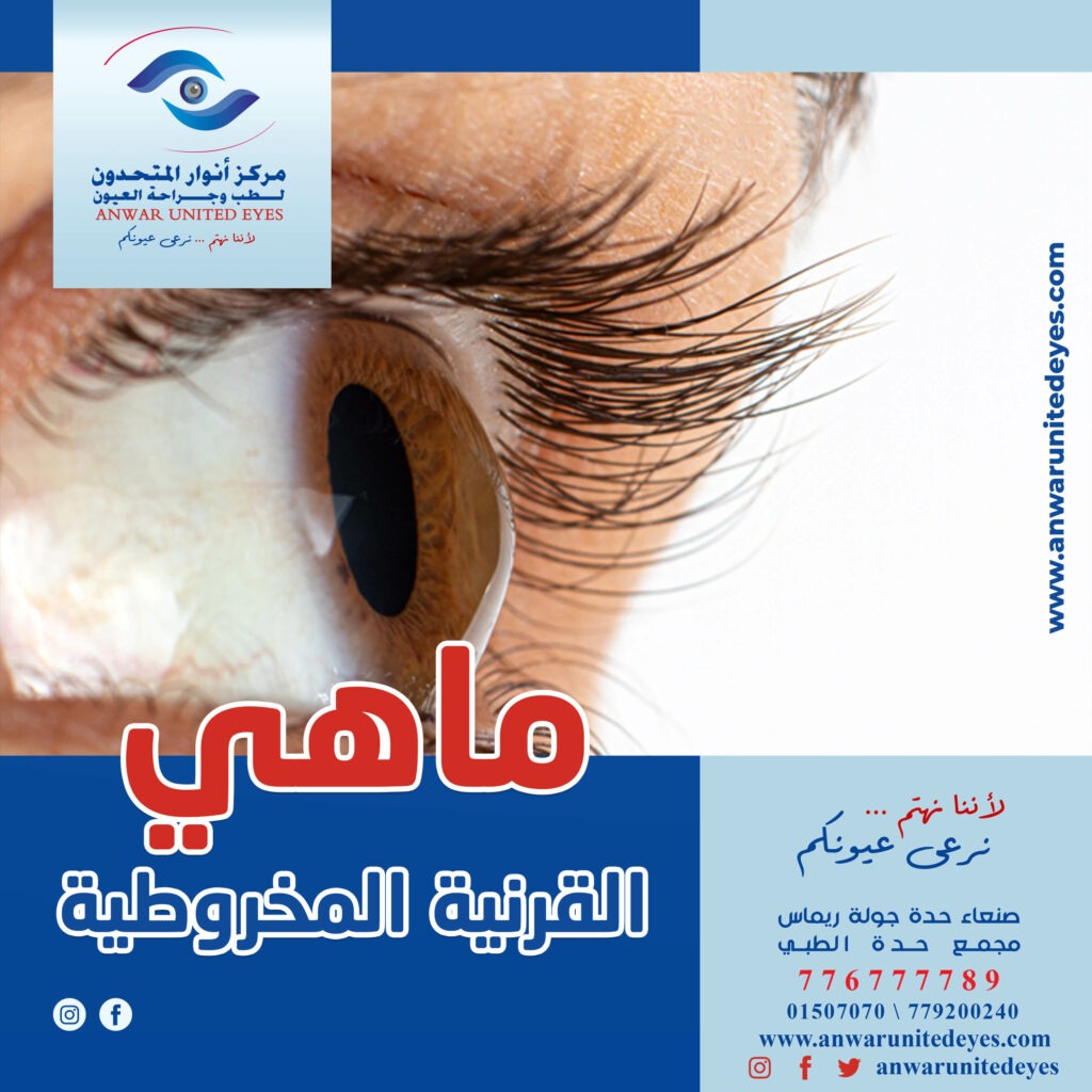 أفضل مركز لعلاج القرنية المخروطية في صنعاء ، اليمن علاج القرنية المخروطية في صنعاء ، اليمن دكتور القرنية المخروطية في صنعاء ، اليمن أفضل مركز لعلاج القرنية المخروطية في صنعاء ، اليمن علاج القرنية المخروطية في صنعاء ، اليمن دكتور القرنية المخروطية في صنعاء ، اليمن أفضل مركز لعلاج القرنية المخروطية في صنعاء ، اليمن علاج القرنية المخروطية في صنعاء ، اليمن دكتور القرنية المخروطية في صنعاء ، اليمن أفضل مركز لعلاج القرنية المخروطية في صنعاء ، اليمن علاج القرنية المخروطية في صنعاء ، اليمن دكتور القرنية المخروطية في صنعاء ، اليمن أفضل مركز لعلاج القرنية المخروطية في صنعاء ، اليمن علاج القرنية المخروطية في صنعاء ، اليمن دكتور القرنية المخروطية في صنعاء ، اليمن أفضل مركز لعلاج القرنية المخروطية في صنعاء ، اليمن علاج القرنية المخروطية في صنعاء ، اليمن دكتور القرنية المخروطية في صنعاء ، اليمن أفضل مركز لعلاج القرنية المخروطية في صنعاء ، اليمن علاج القرنية المخروطية في صنعاء ، اليمن دكتور القرنية المخروطية في صنعاء ، اليمن أفضل مركز لعلاج القرنية المخروطية في صنعاء ، اليمن علاج القرنية المخروطية في صنعاء ، اليمن دكتور القرنية المخروطية في صنعاء ، اليمن أفضل مركز لعلاج القرنية المخروطية في صنعاء ، اليمن علاج القرنية المخروطية في صنعاء ، اليمن دكتور القرنية المخروطية في صنعاء ، اليمن أفضل مركز لعلاج القرنية المخروطية في صنعاء ، اليمن علاج القرنية المخروطية في صنعاء ، اليمن دكتور القرنية المخروطية في صنعاء ، اليمن أفضل مركز لعلاج القرنية المخروطية في صنعاء ، اليمن علاج القرنية المخروطية في صنعاء ، اليمن دكتور القرنية المخروطية في صنعاء ، اليمن أفضل مركز لعلاج القرنية المخروطية في صنعاء ، اليمن علاج القرنية المخروطية في صنعاء ، اليمن دكتور القرنية المخروطية في صنعاء ، اليمن أفضل مركز لعلاج القرنية المخروطية في صنعاء ، اليمن علاج القرنية المخروطية في صنعاء ، اليمن دكتور القرنية المخروطية في صنعاء ، اليمن أفضل مركز لعلاج القرنية المخروطية في صنعاء ، اليمن علاج القرنية المخروطية في صنعاء ، اليمن دكتور القرنية المخروطية في صنعاء ، اليمن أفضل مركز لعلاج القرنية المخروطية في صنعاء ، اليمن علاج القرنية المخروطية في صنعاء ، اليمن دكتور القرنية المخروطية في صنعاء ، اليمن أفضل مركز لعلاج القرنية المخروطية في صنعاء ، اليمن علاج القرنية المخروطية في صنعاء ، اليمن دكتور القرنية المخروطية في صنعاء ، اليمن أفضل مركز لعلاج القرنية المخروطية في صنعاء ، اليمن علاج القرنية المخروطية في صنعاء ، اليمن دكتور القرنية المخروطية في صنعاء ، اليمن أفضل مركز لعلاج القرنية المخروطية في صنعاء ، اليمن علاج القرنية المخروطية في صنعاء ، اليمن دكتور القرنية المخروطية في صنعاء ، اليمن أفضل مركز لعلاج القرنية المخروطية في صنعاء ، اليمن علاج القرنية المخروطية في صنعاء ، اليمن دكتور القرنية المخروطية في صنعاء ، اليمن أفضل مركز لعلاج القرنية المخروطية في صنعاء ، اليمن علاج القرنية المخروطية في صنعاء ، اليمن دكتور القرنية المخروطية في صنعاء ، اليمن أفضل مركز لعلاج القرنية المخروطية في صنعاء ، اليمن علاج القرنية المخروطية في صنعاء ، اليمن دكتور القرنية المخروطية في صنعاء ، اليمن أفضل مركز لعلاج القرنية المخروطية في صنعاء ، اليمن علاج القرنية المخروطية في صنعاء ، اليمن دكتور القرنية المخروطية في صنعاء ، اليمن أفضل مركز لعلاج القرنية المخروطية في صنعاء ، اليمن علاج القرنية المخروطية في صنعاء ، اليمن دكتور القرنية المخروطية في صنعاء ، اليمن أفضل مركز لعلاج القرنية المخروطية في صنعاء ، اليمن علاج القرنية المخروطية في صنعاء ، اليمن دكتور القرنية المخروطية في صنعاء ، اليمن أفضل مركز لعلاج القرنية المخروطية في صنعاء ، اليمن علاج القرنية المخروطية في صنعاء ، اليمن دكتور القرنية المخروطية في صنعاء ، اليمن أفضل مركز لعلاج القرنية المخروطية في صنعاء ، اليمن علاج القرنية المخروطية في صنعاء ، اليمن دكتور القرنية المخروطية في صنعاء ، اليمن أفضل مركز لعلاج القرنية المخروطية في صنعاء ، اليمن علاج القرنية المخروطية في صنعاء ، اليمن دكتور القرنية المخروطية في صنعاء ، اليمن أفضل مركز لعلاج القرنية المخروطية في صنعاء ، اليمن علاج القرنية المخروطية في صنعاء ، اليمن دكتور القرنية المخروطية في صنعاء ، اليمن أفضل مركز لعلاج القرنية المخروطية في صنعاء ، اليمن علاج القرنية المخروطية في صنعاء ، اليمن دكتور القرنية المخروطية في صنعاء ، اليمن أفضل مركز لعلاج القرنية المخروطية في صنعاء ، اليمن علاج القرنية المخروطية في صنعاء ، اليمن دكتور القرنية المخروطية في صنعاء ، اليمن أفضل مركز لعلاج القرنية المخروطية في صنعاء ، اليمن علاج القرنية المخروطية في صنعاء ، اليمن دكتور القرنية المخروطية في صنعاء ، اليمن أفضل مركز لعلاج القرنية المخروطية في صنعاء ، اليمن علاج القرنية المخروطية في صنعاء ، اليمن دكتور القرنية المخروطية في صنعاء ، اليمن أفضل مركز لعلاج القرنية المخروطية في صنعاء ، اليمن علاج القرنية المخروطية في صنعاء ، اليمن دكتور القرنية المخروطية في صنعاء ، اليمن أفضل مركز لعلاج القرنية المخروطية في صنعاء ، اليمن علاج القرنية المخروطية في صنعاء ، اليمن دكتور القرنية المخروطية في صنعاء ، اليمن أفضل مركز لعلاج القرنية المخروطية في صنعاء ، اليمن علاج القرنية المخروطية في صنعاء ، اليمن دكتور القرنية المخروطية في صنعاء ، اليمن أفضل مركز لعلاج القرنية المخروطية في صنعاء ، اليمن علاج القرنية المخروطية في صنعاء ، اليمن دكتور القرنية المخروطية في صنعاء ، اليمن أفضل مركز لعلاج القرنية المخروطية في صنعاء ، اليمن علاج القرنية المخروطية في صنعاء ، اليمن دكتور القرنية المخروطية في صنعاء ، اليمن أفضل مركز لعلاج القرنية المخروطية في صنعاء ، اليمن علاج القرنية المخروطية في صنعاء ، اليمن دكتور القرنية المخروطية في صنعاء ، اليمن أفضل مركز لعلاج القرنية المخروطية في صنعاء ، اليمن علاج القرنية المخروطية في صنعاء ، اليمن دكتور القرنية المخروطية في صنعاء ، اليمن أفضل مركز لعلاج القرنية المخروطية في صنعاء ، اليمن علاج القرنية المخروطية في صنعاء ، اليمن دكتور القرنية المخروطية في صنعاء ، اليمن أفضل مركز لعلاج القرنية المخروطية في صنعاء ، اليمن علاج القرنية المخروطية في صنعاء ، اليمن دكتور القرنية المخروطية في صنعاء ، اليمن أفضل مركز لعلاج القرنية المخروطية في صنعاء ، اليمن علاج القرنية المخروطية في صنعاء ، اليمن دكتور القرنية المخروطية في صنعاء ، اليمن أفضل مركز لعلاج القرنية المخروطية في صنعاء ، اليمن علاج القرنية المخروطية في صنعاء ، اليمن دكتور القرنية المخروطية في صنعاء ، اليمن أفضل مركز لعلاج القرنية المخروطية في صنعاء ، اليمن علاج القرنية المخروطية في صنعاء ، اليمن دكتور القرنية المخروطية في صنعاء ، اليمن أفضل مركز لعلاج القرنية المخروطية في صنعاء ، اليمن علاج القرنية المخروطية في صنعاء ، اليمن دكتور القرنية المخروطية في صنعاء ، اليمن أفضل مركز لعلاج القرنية المخروطية في صنعاء ، اليمن علاج القرنية المخروطية في صنعاء ، اليمن دكتور القرنية المخروطية في صنعاء ، اليمن أفضل مركز لعلاج القرنية المخروطية في صنعاء ، اليمن علاج القرنية المخروطية في صنعاء ، اليمن دكتور القرنية المخروطية في صنعاء ، اليمن أفضل مركز لعلاج القرنية المخروطية في صنعاء ، اليمن علاج القرنية المخروطية في صنعاء ، اليمن دكتور القرنية المخروطية في صنعاء ، اليمن أفضل مركز لعلاج القرنية المخروطية في صنعاء ، اليمن علاج القرنية المخروطية في صنعاء ، اليمن دكتور القرنية المخروطية في صنعاء ، اليمن أفضل مركز لعلاج القرنية المخروطية في صنعاء ، اليمن علاج القرنية المخروطية في صنعاء ، اليمن دكتور القرنية المخروطية في صنعاء ، اليمن أفضل مركز لعلاج القرنية المخروطية في صنعاء ، اليمن علاج القرنية المخروطية في صنعاء ، اليمن دكتور القرنية المخروطية في صنعاء ، اليمن أفضل مركز لعلاج القرنية المخروطية في صنعاء ، اليمن علاج القرنية المخروطية في صنعاء ، اليمن دكتور القرنية المخروطية في صنعاء ، اليمن أفضل مركز لعلاج القرنية المخروطية في صنعاء ، اليمن علاج القرنية المخروطية في صنعاء ، اليمن دكتور القرنية المخروطية في صنعاء ، اليمن أفضل مركز لعلاج القرنية المخروطية في صنعاء ، اليمن علاج القرنية المخروطية في صنعاء ، اليمن دكتور القرنية المخروطية في صنعاء ، اليمن أفضل مركز لعلاج القرنية المخروطية في صنعاء ، اليمن علاج القرنية المخروطية في صنعاء ، اليمن دكتور القرنية المخروطية في صنعاء ، اليمن أفضل مركز لعلاج القرنية المخروطية في صنعاء ، اليمن علاج القرنية المخروطية في صنعاء ، اليمن دكتور القرنية المخروطية في صنعاء ، اليمن أفضل مركز لعلاج القرنية المخروطية في صنعاء ، اليمن علاج القرنية المخروطية في صنعاء ، اليمن دكتور القرنية المخروطية في صنعاء ، اليمن أفضل مركز لعلاج القرنية المخروطية في صنعاء ، اليمن علاج القرنية المخروطية في صنعاء ، اليمن دكتور القرنية المخروطية في صنعاء ، اليمن أفضل مركز لعلاج القرنية المخروطية في صنعاء ، اليمن علاج القرنية المخروطية في صنعاء ، اليمن دكتور القرنية المخروطية في صنعاء ، اليمن أفضل مركز لعلاج القرنية المخروطية في صنعاء ، اليمن علاج القرنية المخروطية في صنعاء ، اليمن دكتور القرنية المخروطية في صنعاء ، اليمن أفضل مركز لعلاج القرنية المخروطية في صنعاء ، اليمن علاج القرنية المخروطية في صنعاء ، اليمن دكتور القرنية المخروطية في صنعاء ، اليمن أفضل مركز لعلاج القرنية المخروطية في صنعاء ، اليمن علاج القرنية المخروطية في صنعاء ، اليمن دكتور القرنية المخروطية في صنعاء ، اليمن أفضل مركز لعلاج القرنية المخروطية في صنعاء ، اليمن علاج القرنية المخروطية في صنعاء ، اليمن دكتور القرنية المخروطية في صنعاء ، اليمن أفضل مركز لعلاج القرنية المخروطية في صنعاء ، اليمن علاج القرنية المخروطية في صنعاء ، اليمن دكتور القرنية المخروطية في صنعاء ، اليمن أفضل مركز لعلاج القرنية المخروطية في صنعاء ، اليمن علاج القرنية المخروطية في صنعاء ، اليمن دكتور القرنية المخروطية في صنعاء ، اليمن أفضل مركز لعلاج القرنية المخروطية في صنعاء ، اليمن علاج القرنية المخروطية في صنعاء ، اليمن دكتور القرنية المخروطية في صنعاء ، اليمن أفضل مركز لعلاج القرنية المخروطية في صنعاء ، اليمن علاج القرنية المخروطية في صنعاء ، اليمن دكتور القرنية المخروطية في صنعاء ، اليمن أفضل مركز لعلاج القرنية المخروطية في صنعاء ، اليمن علاج القرنية المخروطية في صنعاء ، اليمن دكتور القرنية المخروطية في صنعاء ، اليمن أفضل مركز لعلاج القرنية المخروطية في صنعاء ، اليمن علاج القرنية المخروطية في صنعاء ، اليمن دكتور القرنية المخروطية في صنعاء ، اليمن أفضل مركز لعلاج القرنية المخروطية في صنعاء ، اليمن علاج القرنية المخروطية في صنعاء ، اليمن دكتور القرنية المخروطية في صنعاء ، اليمن أفضل مركز لعلاج القرنية المخروطية في صنعاء ، اليمن علاج القرنية المخروطية في صنعاء ، اليمن دكتور القرنية المخروطية في صنعاء ، اليمن أفضل مركز لعلاج القرنية المخروطية في صنعاء ، اليمن علاج القرنية المخروطية في صنعاء ، اليمن دكتور القرنية المخروطية في صنعاء ، اليمن أفضل مركز لعلاج القرنية المخروطية في صنعاء ، اليمن علاج القرنية المخروطية في صنعاء ، اليمن دكتور القرنية المخروطية في صنعاء ، اليمن أفضل مركز لعلاج القرنية المخروطية في صنعاء ، اليمن علاج القرنية المخروطية في صنعاء ، اليمن دكتور القرنية المخروطية في صنعاء ، اليمن أفضل مركز لعلاج القرنية المخروطية في صنعاء ، اليمن علاج القرنية المخروطية في صنعاء ، اليمن دكتور القرنية المخروطية في صنعاء ، اليمن أفضل مركز لعلاج القرنية المخروطية في صنعاء ، اليمن علاج القرنية المخروطية في صنعاء ، اليمن دكتور القرنية المخروطية في صنعاء ، اليمن أفضل مركز لعلاج القرنية المخروطية في صنعاء ، اليمن علاج القرنية المخروطية في صنعاء ، اليمن دكتور القرنية المخروطية في صنعاء ، اليمن أفضل مركز لعلاج القرنية المخروطية في صنعاء ، اليمن علاج القرنية المخروطية في صنعاء ، اليمن دكتور القرنية المخروطية في صنعاء ، اليمن أفضل مركز لعلاج القرنية المخروطية في صنعاء ، اليمن علاج القرنية المخروطية في صنعاء ، اليمن دكتور القرنية المخروطية في صنعاء ، اليمن أفضل مركز لعلاج القرنية المخروطية في صنعاء ، اليمن علاج القرنية المخروطية في صنعاء ، اليمن دكتور القرنية المخروطية في صنعاء ، اليمن أفضل مركز لعلاج القرنية المخروطية في صنعاء ، اليمن علاج القرنية المخروطية في صنعاء ، اليمن دكتور القرنية المخروطية في صنعاء ، اليمن أفضل مركز لعلاج القرنية المخروطية في صنعاء ، اليمن علاج القرنية المخروطية في صنعاء ، اليمن دكتور القرنية المخروطية في صنعاء ، اليمن أفضل مركز لعلاج القرنية المخروطية في صنعاء ، اليمن علاج القرنية المخروطية في صنعاء ، اليمن دكتور القرنية المخروطية في صنعاء ، اليمن أفضل مركز لعلاج القرنية المخروطية في صنعاء ، اليمن علاج القرنية المخروطية في صنعاء ، اليمن دكتور القرنية المخروطية في صنعاء ، اليمن أفضل مركز لعلاج القرنية المخروطية في صنعاء ، اليمن علاج القرنية المخروطية في صنعاء ، اليمن دكتور القرنية المخروطية في صنعاء ، اليمن أفضل مركز لعلاج القرنية المخروطية في صنعاء ، اليمن علاج القرنية المخروطية في صنعاء ، اليمن دكتور القرنية المخروطية في صنعاء ، اليمن أفضل مركز لعلاج القرنية المخروطية في صنعاء ، اليمن علاج القرنية المخروطية في صنعاء ، اليمن دكتور القرنية المخروطية في صنعاء ، اليمن أفضل مركز لعلاج القرنية المخروطية في صنعاء ، اليمن علاج القرنية المخروطية في صنعاء ، اليمن دكتور القرنية المخروطية في صنعاء ، اليمن أفضل مركز لعلاج القرنية المخروطية في صنعاء ، اليمن علاج القرنية المخروطية في صنعاء ، اليمن دكتور القرنية المخروطية في صنعاء ، اليمن أفضل مركز لعلاج القرنية المخروطية في صنعاء ، اليمن علاج القرنية المخروطية في صنعاء ، اليمن دكتور القرنية المخروطية في صنعاء ، اليمن أفضل مركز لعلاج القرنية المخروطية في صنعاء ، اليمن علاج القرنية المخروطية في صنعاء ، اليمن دكتور القرنية المخروطية في صنعاء ، اليمن أفضل مركز لعلاج القرنية المخروطية في صنعاء ، اليمن علاج القرنية المخروطية في صنعاء ، اليمن دكتور القرنية المخروطية في صنعاء ، اليمن أفضل مركز لعلاج القرنية المخروطية في صنعاء ، اليمن علاج القرنية المخروطية في صنعاء ، اليمن دكتور القرنية المخروطية في صنعاء ، اليمن أفضل مركز لعلاج القرنية المخروطية في صنعاء ، اليمن علاج القرنية المخروطية في صنعاء ، اليمن دكتور القرنية المخروطية في صنعاء ، اليمن أفضل مركز لعلاج القرنية المخروطية في صنعاء ، اليمن علاج القرنية المخروطية في صنعاء ، اليمن دكتور القرنية المخروطية في صنعاء ، اليمن أفضل مركز لعلاج القرنية المخروطية في صنعاء ، اليمن علاج القرنية المخروطية في صنعاء ، اليمن دكتور القرنية المخروطية في صنعاء ، اليمن أفضل مركز لعلاج القرنية المخروطية في صنعاء ، اليمن علاج القرنية المخروطية في صنعاء ، اليمن دكتور القرنية المخروطية في صنعاء ، اليمن أفضل مركز لعلاج القرنية المخروطية في صنعاء ، اليمن علاج القرنية المخروطية في صنعاء ، اليمن دكتور القرنية المخروطية في صنعاء ، اليمن أفضل مركز لعلاج القرنية المخروطية في صنعاء ، اليمن علاج القرنية المخروطية في صنعاء ، اليمن دكتور القرنية المخروطية في صنعاء ، اليمن أفضل مركز لعلاج القرنية المخروطية في صنعاء ، اليمن علاج القرنية المخروطية في صنعاء ، اليمن دكتور القرنية المخروطية في صنعاء ، اليمن أفضل مركز لعلاج القرنية المخروطية في صنعاء ، اليمن علاج القرنية المخروطية في صنعاء ، اليمن دكتور القرنية المخروطية في صنعاء ، اليمن أفضل مركز لعلاج القرنية المخروطية في صنعاء ، اليمن علاج القرنية المخروطية في صنعاء ، اليمن دكتور القرنية المخروطية في صنعاء ، اليمن أفضل مركز لعلاج القرنية المخروطية في صنعاء ، اليمن علاج القرنية المخروطية في صنعاء ، اليمن دكتور القرنية المخروطية في صنعاء ، اليمن أفضل مركز لعلاج القرنية المخروطية في صنعاء ، اليمن علاج القرنية المخروطية في صنعاء ، اليمن دكتور القرنية المخروطية في صنعاء ، اليمن أفضل مركز لعلاج القرنية المخروطية في صنعاء ، اليمن علاج القرنية المخروطية في صنعاء ، اليمن دكتور القرنية المخروطية في صنعاء ، اليمن أفضل مركز لعلاج القرنية المخروطية في صنعاء ، اليمن علاج القرنية المخروطية في صنعاء ، اليمن دكتور القرنية المخروطية في صنعاء ، اليمن أفضل مركز لعلاج القرنية المخروطية في صنعاء ، اليمن علاج القرنية المخروطية في صنعاء ، اليمن دكتور القرنية المخروطية في صنعاء ، اليمن أفضل مركز لعلاج القرنية المخروطية في صنعاء ، اليمن علاج القرنية المخروطية في صنعاء ، اليمن دكتور القرنية المخروطية في صنعاء ، اليمن أفضل مركز لعلاج القرنية المخروطية في صنعاء ، اليمن علاج القرنية المخروطية في صنعاء ، اليمن دكتور القرنية المخروطية في صنعاء ، اليمن أفضل مركز لعلاج القرنية المخروطية في صنعاء ، اليمن علاج القرنية المخروطية في صنعاء ، اليمن دكتور القرنية المخروطية في صنعاء ، اليمن أفضل مركز لعلاج القرنية المخروطية في صنعاء ، اليمن علاج القرنية المخروطية في صنعاء ، اليمن دكتور القرنية المخروطية في صنعاء ، اليمن أفضل مركز لعلاج القرنية المخروطية في صنعاء ، اليمن علاج القرنية المخروطية في صنعاء ، اليمن دكتور القرنية المخروطية في صنعاء ، اليمن أفضل مركز لعلاج القرنية المخروطية في صنعاء ، اليمن علاج القرنية المخروطية في صنعاء ، اليمن دكتور القرنية المخروطية في صنعاء ، اليمن أفضل مركز لعلاج القرنية المخروطية في صنعاء ، اليمن علاج القرنية المخروطية في صنعاء ، اليمن دكتور القرنية المخروطية في صنعاء ، اليمن أفضل مركز لعلاج القرنية المخروطية في صنعاء ، اليمن علاج القرنية المخروطية في صنعاء ، اليمن دكتور القرنية المخروطية في صنعاء ، اليمن أفضل مركز لعلاج القرنية المخروطية في صنعاء ، اليمن علاج القرنية المخروطية في صنعاء ، اليمن دكتور القرنية المخروطية في صنعاء ، اليمن أفضل مركز لعلاج القرنية المخروطية في صنعاء ، اليمن علاج القرنية المخروطية في صنعاء ، اليمن دكتور القرنية المخروطية في صنعاء ، اليمن أفضل مركز لعلاج القرنية المخروطية في صنعاء ، اليمن علاج القرنية المخروطية في صنعاء ، اليمن دكتور القرنية المخروطية في صنعاء ، اليمن أفضل مركز لعلاج القرنية المخروطية في صنعاء ، اليمن علاج القرنية المخروطية في صنعاء ، اليمن دكتور القرنية المخروطية في صنعاء ، اليمن أفضل مركز لعلاج القرنية المخروطية في صنعاء ، اليمن علاج القرنية المخروطية في صنعاء ، اليمن دكتور القرنية المخروطية في صنعاء ، اليمن أفضل مركز لعلاج القرنية المخروطية في صنعاء ، اليمن علاج القرنية المخروطية في صنعاء ، اليمن دكتور القرنية المخروطية في صنعاء ، اليمن أفضل مركز لعلاج القرنية المخروطية في صنعاء ، اليمن علاج القرنية المخروطية في صنعاء ، اليمن دكتور القرنية المخروطية في صنعاء ، اليمن أفضل مركز لعلاج القرنية المخروطية في صنعاء ، اليمن علاج القرنية المخروطية في صنعاء ، اليمن دكتور القرنية المخروطية في صنعاء ، اليمن أفضل مركز لعلاج القرنية المخروطية في صنعاء ، اليمن علاج القرنية المخروطية في صنعاء ، اليمن دكتور القرنية المخروطية في صنعاء ، اليمن أفضل مركز لعلاج القرنية المخروطية في صنعاء ، اليمن علاج القرنية المخروطية في صنعاء ، اليمن دكتور القرنية المخروطية في صنعاء ، اليمن أفضل مركز لعلاج القرنية المخروطية في صنعاء ، اليمن علاج القرنية المخروطية في صنعاء ، اليمن دكتور القرنية المخروطية في صنعاء ، اليمن أفضل مركز لعلاج القرنية المخروطية في صنعاء ، اليمن علاج القرنية المخروطية في صنعاء ، اليمن دكتور القرنية المخروطية في صنعاء ، اليمن أفضل مركز لعلاج القرنية المخروطية في صنعاء ، اليمن علاج القرنية المخروطية في صنعاء ، اليمن دكتور القرنية المخروطية في صنعاء ، اليمن أفضل مركز لعلاج القرنية المخروطية في صنعاء ، اليمن علاج القرنية المخروطية في صنعاء ، اليمن دكتور القرنية المخروطية في صنعاء ، اليمن أفضل مركز لعلاج القرنية المخروطية في صنعاء ، اليمن علاج القرنية المخروطية في صنعاء ، اليمن دكتور القرنية المخروطية في صنعاء ، اليمن أفضل مركز لعلاج القرنية المخروطية في صنعاء ، اليمن علاج القرنية المخروطية في صنعاء ، اليمن دكتور القرنية المخروطية في صنعاء ، اليمن أفضل مركز لعلاج القرنية المخروطية في صنعاء ، اليمن علاج القرنية المخروطية في صنعاء ، اليمن دكتور القرنية المخروطية في صنعاء ، اليمن أفضل مركز لعلاج القرنية المخروطية في صنعاء ، اليمن علاج القرنية المخروطية في صنعاء ، اليمن دكتور القرنية المخروطية في صنعاء ، اليمن أفضل مركز لعلاج القرنية المخروطية في صنعاء ، اليمن علاج القرنية المخروطية في صنعاء ، اليمن دكتور القرنية المخروطية في صنعاء ، اليمن أفضل مركز لعلاج القرنية المخروطية في صنعاء ، اليمن علاج القرنية المخروطية في صنعاء ، اليمن دكتور القرنية المخروطية في صنعاء ، اليمن أفضل مركز لعلاج القرنية المخروطية في صنعاء ، اليمن علاج القرنية المخروطية في صنعاء ، اليمن دكتور القرنية المخروطية في صنعاء ، اليمن أفضل مركز لعلاج القرنية المخروطية في صنعاء ، اليمن علاج القرنية المخروطية في صنعاء ، اليمن دكتور القرنية المخروطية في صنعاء ، اليمن أفضل مركز لعلاج القرنية المخروطية في صنعاء ، اليمن علاج القرنية المخروطية في صنعاء ، اليمن دكتور القرنية المخروطية في صنعاء ، اليمن أفضل مركز لعلاج القرنية المخروطية في صنعاء ، اليمن علاج القرنية المخروطية في صنعاء ، اليمن دكتور القرنية المخروطية في صنعاء ، اليمن أفضل مركز لعلاج القرنية المخروطية في صنعاء ، اليمن علاج القرنية المخروطية في صنعاء ، اليمن دكتور القرنية المخروطية في صنعاء ، اليمن أفضل مركز لعلاج القرنية المخروطية في صنعاء ، اليمن علاج القرنية المخروطية في صنعاء ، اليمن دكتور القرنية المخروطية في صنعاء ، اليمن أفضل مركز لعلاج القرنية المخروطية في صنعاء ، اليمن علاج القرنية المخروطية في صنعاء ، اليمن دكتور القرنية المخروطية في صنعاء ، اليمن أفضل مركز لعلاج القرنية المخروطية في صنعاء ، اليمن علاج القرنية المخروطية في صنعاء ، اليمن دكتور القرنية المخروطية في صنعاء ، اليمن أفضل مركز لعلاج القرنية المخروطية في صنعاء ، اليمن علاج القرنية المخروطية في صنعاء ، اليمن دكتور القرنية المخروطية في صنعاء ، اليمن أفضل مركز لعلاج القرنية المخروطية في صنعاء ، اليمن علاج القرنية المخروطية في صنعاء ، اليمن دكتور القرنية المخروطية في صنعاء ، اليمن أفضل مركز لعلاج القرنية المخروطية في صنعاء ، اليمن علاج القرنية المخروطية في صنعاء ، اليمن دكتور القرنية المخروطية في صنعاء ، اليمن أفضل مركز لعلاج القرنية المخروطية في صنعاء ، اليمن علاج القرنية المخروطية في صنعاء ، اليمن دكتور القرنية المخروطية في صنعاء ، اليمن أفضل مركز لعلاج القرنية المخروطية في صنعاء ، اليمن علاج القرنية المخروطية في صنعاء ، اليمن دكتور القرنية المخروطية في صنعاء ، اليمن أفضل مركز لعلاج القرنية المخروطية في صنعاء ، اليمن علاج القرنية المخروطية في صنعاء ، اليمن دكتور القرنية المخروطية في صنعاء ، اليمن أفضل مركز لعلاج القرنية المخروطية في صنعاء ، اليمن علاج القرنية المخروطية في صنعاء ، اليمن دكتور القرنية المخروطية في صنعاء ، اليمن أفضل مركز لعلاج القرنية المخروطية في صنعاء ، اليمن علاج القرنية المخروطية في صنعاء ، اليمن دكتور القرنية المخروطية في صنعاء ، اليمن أفضل مركز لعلاج القرنية المخروطية في صنعاء ، اليمن علاج القرنية المخروطية في صنعاء ، اليمن دكتور القرنية المخروطية في صنعاء ، اليمن أفضل مركز لعلاج القرنية المخروطية في صنعاء ، اليمن علاج القرنية المخروطية في صنعاء ، اليمن دكتور القرنية المخروطية في صنعاء ، اليمن أفضل مركز لعلاج القرنية المخروطية في صنعاء ، اليمن علاج القرنية المخروطية في صنعاء ، اليمن دكتور القرنية المخروطية في صنعاء ، اليمن أفضل مركز لعلاج القرنية المخروطية في صنعاء ، اليمن علاج القرنية المخروطية في صنعاء ، اليمن دكتور القرنية المخروطية في صنعاء ، اليمن أفضل مركز لعلاج القرنية المخروطية في صنعاء ، اليمن علاج القرنية المخروطية في صنعاء ، اليمن دكتور القرنية المخروطية في صنعاء ، اليمن أفضل مركز لعلاج القرنية المخروطية في صنعاء ، اليمن علاج القرنية المخروطية في صنعاء ، اليمن دكتور القرنية المخروطية في صنعاء ، اليمن أفضل مركز لعلاج القرنية المخروطية في صنعاء ، اليمن علاج القرنية المخروطية في صنعاء ، اليمن دكتور القرنية المخروطية في صنعاء ، اليمن أفضل مركز لعلاج القرنية المخروطية في صنعاء ، اليمن علاج القرنية المخروطية في صنعاء ، اليمن دكتور القرنية المخروطية في صنعاء ، اليمن أفضل مركز لعلاج القرنية المخروطية في صنعاء ، اليمن علاج القرنية المخروطية في صنعاء ، اليمن دكتور القرنية المخروطية في صنعاء ، اليمن أفضل مركز لعلاج القرنية المخروطية في صنعاء ، اليمن علاج القرنية المخروطية في صنعاء ، اليمن دكتور القرنية المخروطية في صنعاء ، اليمن أفضل مركز لعلاج القرنية المخروطية في صنعاء ، اليمن علاج القرنية المخروطية في صنعاء ، اليمن دكتور القرنية المخروطية في صنعاء ، اليمن أفضل مركز لعلاج القرنية المخروطية في صنعاء ، اليمن علاج القرنية المخروطية في صنعاء ، اليمن دكتور القرنية المخروطية في صنعاء ، اليمن أفضل مركز لعلاج القرنية المخروطية في صنعاء ، اليمن علاج القرنية المخروطية في صنعاء ، اليمن دكتور القرنية المخروطية في صنعاء ، اليمن أفضل مركز لعلاج القرنية المخروطية في صنعاء ، اليمن علاج القرنية المخروطية في صنعاء ، اليمن دكتور القرنية المخروطية في صنعاء ، اليمن أفضل مركز لعلاج القرنية المخروطية في صنعاء ، اليمن علاج القرنية المخروطية في صنعاء ، اليمن دكتور القرنية المخروطية في صنعاء ، اليمن أفضل مركز لعلاج القرنية المخروطية في صنعاء ، اليمن علاج القرنية المخروطية في صنعاء ، اليمن دكتور القرنية المخروطية في صنعاء ، اليمن أفضل مركز لعلاج القرنية المخروطية في صنعاء ، اليمن علاج القرنية المخروطية في صنعاء ، اليمن دكتور القرنية المخروطية في صنعاء ، اليمن أفضل مركز لعلاج القرنية المخروطية في صنعاء ، اليمن علاج القرنية المخروطية في صنعاء ، اليمن دكتور القرنية المخروطية في صنعاء ، اليمن أفضل مركز لعلاج القرنية المخروطية في صنعاء ، اليمن علاج القرنية المخروطية في صنعاء ، اليمن دكتور القرنية المخروطية في صنعاء ، اليمن أفضل مركز لعلاج القرنية المخروطية في صنعاء ، اليمن علاج القرنية المخروطية في صنعاء ، اليمن دكتور القرنية المخروطية في صنعاء ، اليمن أفضل مركز لعلاج القرنية المخروطية في صنعاء ، اليمن علاج القرنية المخروطية في صنعاء ، اليمن دكتور القرنية المخروطية في صنعاء ، اليمن أفضل مركز لعلاج القرنية المخروطية في صنعاء ، اليمن علاج القرنية المخروطية في صنعاء ، اليمن دكتور القرنية المخروطية في صنعاء ، اليمن أفضل مركز لعلاج القرنية المخروطية في صنعاء ، اليمن علاج القرنية المخروطية في صنعاء ، اليمن دكتور القرنية المخروطية في صنعاء ، اليمن أفضل مركز لعلاج القرنية المخروطية في صنعاء ، اليمن علاج القرنية المخروطية في صنعاء ، اليمن دكتور القرنية المخروطية في صنعاء ، اليمن أفضل مركز لعلاج القرنية المخروطية في صنعاء ، اليمن علاج القرنية المخروطية في صنعاء ، اليمن دكتور القرنية المخروطية في صنعاء ، اليمن أفضل مركز لعلاج القرنية المخروطية في صنعاء ، اليمن علاج القرنية المخروطية في صنعاء ، اليمن دكتور القرنية المخروطية في صنعاء ، اليمن أفضل مركز لعلاج القرنية المخروطية في صنعاء ، اليمن علاج القرنية المخروطية في صنعاء ، اليمن دكتور القرنية المخروطية في صنعاء ، اليمن أفضل مركز لعلاج القرنية المخروطية في صنعاء ، اليمن علاج القرنية المخروطية في صنعاء ، اليمن دكتور القرنية المخروطية في صنعاء ، اليمن أفضل مركز لعلاج القرنية المخروطية في صنعاء ، اليمن علاج القرنية المخروطية في صنعاء ، اليمن دكتور القرنية المخروطية في صنعاء ، اليمن أفضل مركز لعلاج القرنية المخروطية في صنعاء ، اليمن علاج القرنية المخروطية في صنعاء ، اليمن دكتور القرنية المخروطية في صنعاء ، اليمن أفضل مركز لعلاج القرنية المخروطية في صنعاء ، اليمن علاج القرنية المخروطية في صنعاء ، اليمن دكتور القرنية المخروطية في صنعاء ، اليمن أفضل مركز لعلاج القرنية المخروطية في صنعاء ، اليمن علاج القرنية المخروطية في صنعاء ، اليمن دكتور القرنية المخروطية في صنعاء ، اليمن أفضل مركز لعلاج القرنية المخروطية في صنعاء ، اليمن علاج القرنية المخروطية في صنعاء ، اليمن دكتور القرنية المخروطية في صنعاء ، اليمن أفضل مركز لعلاج القرنية المخروطية في صنعاء ، اليمن علاج القرنية المخروطية في صنعاء ، اليمن دكتور القرنية المخروطية في صنعاء ، اليمن أفضل مركز لعلاج القرنية المخروطية في صنعاء ، اليمن علاج القرنية المخروطية في صنعاء ، اليمن دكتور القرنية المخروطية في صنعاء ، اليمن أفضل مركز لعلاج القرنية المخروطية في صنعاء ، اليمن علاج القرنية المخروطية في صنعاء ، اليمن دكتور القرنية المخروطية في صنعاء ، اليمن أفضل مركز لعلاج القرنية المخروطية في صنعاء ، اليمن علاج القرنية المخروطية في صنعاء ، اليمن دكتور القرنية المخروطية في صنعاء ، اليمن أفضل مركز لعلاج القرنية المخروطية في صنعاء ، اليمن علاج القرنية المخروطية في صنعاء ، اليمن دكتور القرنية المخروطية في صنعاء ، اليمن أفضل مركز لعلاج القرنية المخروطية في صنعاء ، اليمن علاج القرنية المخروطية في صنعاء ، اليمن دكتور القرنية المخروطية في صنعاء ، اليمن أفضل مركز لعلاج القرنية المخروطية في صنعاء ، اليمن علاج القرنية المخروطية في صنعاء ، اليمن دكتور القرنية المخروطية في صنعاء ، اليمن أفضل مركز لعلاج القرنية المخروطية في صنعاء ، اليمن علاج القرنية المخروطية في صنعاء ، اليمن دكتور القرنية المخروطية في صنعاء ، اليمن أفضل مركز لعلاج القرنية المخروطية في صنعاء ، اليمن علاج القرنية المخروطية في صنعاء ، اليمن دكتور القرنية المخروطية في صنعاء ، اليمن أفضل مركز لعلاج القرنية المخروطية في صنعاء ، اليمن علاج القرنية المخروطية في صنعاء ، اليمن دكتور القرنية المخروطية في صنعاء ، اليمن أفضل مركز لعلاج القرنية المخروطية في صنعاء ، اليمن علاج القرنية المخروطية في صنعاء ، اليمن دكتور القرنية المخروطية في صنعاء ، اليمن أفضل مركز لعلاج القرنية المخروطية في صنعاء ، اليمن علاج القرنية المخروطية في صنعاء ، اليمن دكتور القرنية المخروطية في صنعاء ، اليمن أفضل مركز لعلاج القرنية المخروطية في صنعاء ، اليمن علاج القرنية المخروطية في صنعاء ، اليمن دكتور القرنية المخروطية في صنعاء ، اليمن أفضل مركز لعلاج القرنية المخروطية في صنعاء ، اليمن علاج القرنية المخروطية في صنعاء ، اليمن دكتور القرنية المخروطية في صنعاء ، اليمن أفضل مركز لعلاج القرنية المخروطية في صنعاء ، اليمن علاج القرنية المخروطية في صنعاء ، اليمن دكتور القرنية المخروطية في صنعاء ، اليمن أفضل مركز لعلاج القرنية المخروطية في صنعاء ، اليمن علاج القرنية المخروطية في صنعاء ، اليمن دكتور القرنية المخروطية في صنعاء ، اليمن أفضل مركز لعلاج القرنية المخروطية في صنعاء ، اليمن علاج القرنية المخروطية في صنعاء ، اليمن دكتور القرنية المخروطية في صنعاء ، اليمن أفضل مركز لعلاج القرنية المخروطية في صنعاء ، اليمن علاج القرنية المخروطية في صنعاء ، اليمن دكتور القرنية المخروطية في صنعاء ، اليمن أفضل مركز لعلاج القرنية المخروطية في صنعاء ، اليمن علاج القرنية المخروطية في صنعاء ، اليمن دكتور القرنية المخروطية في صنعاء ، اليمن أفضل مركز لعلاج القرنية المخروطية في صنعاء ، اليمن علاج القرنية المخروطية في صنعاء ، اليمن دكتور القرنية المخروطية في صنعاء ، اليمن أفضل مركز لعلاج القرنية المخروطية في صنعاء ، اليمن علاج القرنية المخروطية في صنعاء ، اليمن دكتور القرنية المخروطية في صنعاء ، اليمن أفضل مركز لعلاج القرنية المخروطية في صنعاء ، اليمن علاج القرنية المخروطية في صنعاء ، اليمن دكتور القرنية المخروطية في صنعاء ، اليمن أفضل مركز لعلاج القرنية المخروطية في صنعاء ، اليمن علاج القرنية المخروطية في صنعاء ، اليمن دكتور القرنية المخروطية في صنعاء ، اليمن أفضل مركز لعلاج القرنية المخروطية في صنعاء ، اليمن علاج القرنية المخروطية في صنعاء ، اليمن دكتور القرنية المخروطية في صنعاء ، اليمن أفضل مركز لعلاج القرنية المخروطية في صنعاء ، اليمن علاج القرنية المخروطية في صنعاء ، اليمن دكتور القرنية المخروطية في صنعاء ، اليمن أفضل مركز لعلاج القرنية المخروطية في صنعاء ، اليمن علاج القرنية المخروطية في صنعاء ، اليمن دكتور القرنية المخروطية في صنعاء ، اليمن أفضل مركز لعلاج القرنية المخروطية في صنعاء ، اليمن علاج القرنية المخروطية في صنعاء ، اليمن دكتور القرنية المخروطية في صنعاء ، اليمن أفضل مركز لعلاج القرنية المخروطية في صنعاء ، اليمن علاج القرنية المخروطية في صنعاء ، اليمن دكتور القرنية المخروطية في صنعاء ، اليمن أفضل مركز لعلاج القرنية المخروطية في صنعاء ، اليمن علاج القرنية المخروطية في صنعاء ، اليمن دكتور القرنية المخروطية في صنعاء ، اليمن أفضل مركز لعلاج القرنية المخروطية في صنعاء ، اليمن علاج القرنية المخروطية في صنعاء ، اليمن دكتور القرنية المخروطية في صنعاء ، اليمن أفضل مركز لعلاج القرنية المخروطية في صنعاء ، اليمن علاج القرنية المخروطية في صنعاء ، اليمن دكتور القرنية المخروطية في صنعاء ، اليمن أفضل مركز لعلاج القرنية المخروطية في صنعاء ، اليمن علاج القرنية المخروطية في صنعاء ، اليمن دكتور القرنية المخروطية في صنعاء ، اليمن أفضل مركز لعلاج القرنية المخروطية في صنعاء ، اليمن علاج القرنية المخروطية في صنعاء ، اليمن دكتور القرنية المخروطية في صنعاء ، اليمن أفضل مركز لعلاج القرنية المخروطية في صنعاء ، اليمن علاج القرنية المخروطية في صنعاء ، اليمن دكتور القرنية المخروطية في صنعاء ، اليمن أفضل مركز لعلاج القرنية المخروطية في صنعاء ، اليمن علاج القرنية المخروطية في صنعاء ، اليمن دكتور القرنية المخروطية في صنعاء ، اليمن أفضل مركز لعلاج القرنية المخروطية في صنعاء ، اليمن علاج القرنية المخروطية في صنعاء ، اليمن دكتور القرنية المخروطية في صنعاء ، اليمن أفضل مركز لعلاج القرنية المخروطية في صنعاء ، اليمن علاج القرنية المخروطية في صنعاء ، اليمن دكتور القرنية المخروطية في صنعاء ، اليمن أفضل مركز لعلاج القرنية المخروطية في صنعاء ، اليمن علاج القرنية المخروطية في صنعاء ، اليمن دكتور القرنية المخروطية في صنعاء ، اليمن أفضل مركز لعلاج القرنية المخروطية في صنعاء ، اليمن علاج القرنية المخروطية في صنعاء ، اليمن دكتور القرنية المخروطية في صنعاء ، اليمن أفضل مركز لعلاج القرنية المخروطية في صنعاء ، اليمن علاج القرنية المخروطية في صنعاء ، اليمن دكتور القرنية المخروطية في صنعاء ، اليمن أفضل مركز لعلاج القرنية المخروطية في صنعاء ، اليمن علاج القرنية المخروطية في صنعاء ، اليمن دكتور القرنية المخروطية في صنعاء ، اليمن أفضل مركز لعلاج القرنية المخروطية في صنعاء ، اليمن علاج القرنية المخروطية في صنعاء ، اليمن دكتور القرنية المخروطية في صنعاء ، اليمن أفضل مركز لعلاج القرنية المخروطية في صنعاء ، اليمن علاج القرنية المخروطية في صنعاء ، اليمن دكتور القرنية المخروطية في صنعاء ، اليمن أفضل مركز لعلاج القرنية المخروطية في صنعاء ، اليمن علاج القرنية المخروطية في صنعاء ، اليمن دكتور القرنية المخروطية في صنعاء ، اليمن أفضل مركز لعلاج القرنية المخروطية في صنعاء ، اليمن علاج القرنية المخروطية في صنعاء ، اليمن دكتور القرنية المخروطية في صنعاء ، اليمن أفضل مركز لعلاج القرنية المخروطية في صنعاء ، اليمن علاج القرنية المخروطية في صنعاء ، اليمن دكتور القرنية المخروطية في صنعاء ، اليمن أفضل مركز لعلاج القرنية المخروطية في صنعاء ، اليمن علاج القرنية المخروطية في صنعاء ، اليمن دكتور القرنية المخروطية في صنعاء ، اليمن أفضل مركز لعلاج القرنية المخروطية في صنعاء ، اليمن علاج القرنية المخروطية في صنعاء ، اليمن دكتور القرنية المخروطية في صنعاء ، اليمن أفضل مركز لعلاج القرنية المخروطية في صنعاء ، اليمن علاج القرنية المخروطية في صنعاء ، اليمن دكتور القرنية المخروطية في صنعاء ، اليمن أفضل مركز لعلاج القرنية المخروطية في صنعاء ، اليمن علاج القرنية المخروطية في صنعاء ، اليمن دكتور القرنية المخروطية في صنعاء ، اليمن أفضل مركز لعلاج القرنية المخروطية في صنعاء ، اليمن علاج القرنية المخروطية في صنعاء ، اليمن دكتور القرنية المخروطية في صنعاء ، اليمن أفضل مركز لعلاج القرنية المخروطية في صنعاء ، اليمن علاج القرنية المخروطية في صنعاء ، اليمن دكتور القرنية المخروطية في صنعاء ، اليمن أفضل مركز لعلاج القرنية المخروطية في صنعاء ، اليمن علاج القرنية المخروطية في صنعاء ، اليمن دكتور القرنية المخروطية في صنعاء ، اليمن أفضل مركز لعلاج القرنية المخروطية في صنعاء ، اليمن علاج القرنية المخروطية في صنعاء ، اليمن دكتور القرنية المخروطية في صنعاء ، اليمن أفضل مركز لعلاج القرنية المخروطية في صنعاء ، اليمن علاج القرنية المخروطية في صنعاء ، اليمن دكتور القرنية المخروطية في صنعاء ، اليمن أفضل مركز لعلاج القرنية المخروطية في صنعاء ، اليمن علاج القرنية المخروطية في صنعاء ، اليمن دكتور القرنية المخروطية في صنعاء ، اليمن أفضل مركز لعلاج القرنية المخروطية في صنعاء ، اليمن علاج القرنية المخروطية في صنعاء ، اليمن دكتور القرنية المخروطية في صنعاء ، اليمن أفضل مركز لعلاج القرنية المخروطية في صنعاء ، اليمن علاج القرنية المخروطية في صنعاء ، اليمن دكتور القرنية المخروطية في صنعاء ، اليمن أفضل مركز لعلاج القرنية المخروطية في صنعاء ، اليمن علاج القرنية المخروطية في صنعاء ، اليمن دكتور القرنية المخروطية في صنعاء ، اليمن أفضل مركز لعلاج القرنية المخروطية في صنعاء ، اليمن علاج القرنية المخروطية في صنعاء ، اليمن دكتور القرنية المخروطية في صنعاء ، اليمن أفضل مركز لعلاج القرنية المخروطية في صنعاء ، اليمن علاج القرنية المخروطية في صنعاء ، اليمن دكتور القرنية المخروطية في صنعاء ، اليمن أفضل مركز لعلاج القرنية المخروطية في صنعاء ، اليمن علاج القرنية المخروطية في صنعاء ، اليمن دكتور القرنية المخروطية في صنعاء ، اليمن أفضل مركز لعلاج القرنية المخروطية في صنعاء ، اليمن علاج القرنية المخروطية في صنعاء ، اليمن دكتور القرنية المخروطية في صنعاء ، اليمن أفضل مركز لعلاج القرنية المخروطية في صنعاء ، اليمن علاج القرنية المخروطية في صنعاء ، اليمن دكتور القرنية المخروطية في صنعاء ، اليمن أفضل مركز لعلاج القرنية المخروطية في صنعاء ، اليمن علاج القرنية المخروطية في صنعاء ، اليمن دكتور القرنية المخروطية في صنعاء ، اليمن أفضل مركز لعلاج القرنية المخروطية في صنعاء ، اليمن علاج القرنية المخروطية في صنعاء ، اليمن دكتور القرنية المخروطية في صنعاء ، اليمن أفضل مركز لعلاج القرنية المخروطية في صنعاء ، اليمن علاج القرنية المخروطية في صنعاء ، اليمن دكتور القرنية المخروطية في صنعاء ، اليمن أفضل مركز لعلاج القرنية المخروطية في صنعاء ، اليمن علاج القرنية المخروطية في صنعاء ، اليمن دكتور القرنية المخروطية في صنعاء ، اليمن أفضل مركز لعلاج القرنية المخروطية في صنعاء ، اليمن علاج القرنية المخروطية في صنعاء ، اليمن دكتور القرنية المخروطية في صنعاء ، اليمن أفضل مركز لعلاج القرنية المخروطية في صنعاء ، اليمن علاج القرنية المخروطية في صنعاء ، اليمن دكتور القرنية المخروطية في صنعاء ، اليمن أفضل مركز لعلاج القرنية المخروطية في صنعاء ، اليمن علاج القرنية المخروطية في صنعاء ، اليمن دكتور القرنية المخروطية في صنعاء ، اليمن أفضل مركز لعلاج القرنية المخروطية في صنعاء ، اليمن علاج القرنية المخروطية في صنعاء ، اليمن دكتور القرنية المخروطية في صنعاء ، اليمن أفضل مركز لعلاج القرنية المخروطية في صنعاء ، اليمن علاج القرنية المخروطية في صنعاء ، اليمن دكتور القرنية المخروطية في صنعاء ، اليمن أفضل مركز لعلاج القرنية المخروطية في صنعاء ، اليمن علاج القرنية المخروطية في صنعاء ، اليمن دكتور القرنية المخروطية في صنعاء ، اليمن أفضل مركز لعلاج القرنية المخروطية في صنعاء ، اليمن علاج القرنية المخروطية في صنعاء ، اليمن دكتور القرنية المخروطية في صنعاء ، اليمن أفضل مركز لعلاج القرنية المخروطية في صنعاء ، اليمن علاج القرنية المخروطية في صنعاء ، اليمن دكتور القرنية المخروطية في صنعاء ، اليمن أفضل مركز لعلاج القرنية المخروطية في صنعاء ، اليمن علاج القرنية المخروطية في صنعاء ، اليمن دكتور القرنية المخروطية في صنعاء ، اليمن أفضل مركز لعلاج القرنية المخروطية في صنعاء ، اليمن علاج القرنية المخروطية في صنعاء ، اليمن دكتور القرنية المخروطية في صنعاء ، اليمن أفضل مركز لعلاج القرنية المخروطية في صنعاء ، اليمن علاج القرنية المخروطية في صنعاء ، اليمن دكتور القرنية المخروطية في صنعاء ، اليمن أفضل مركز لعلاج القرنية المخروطية في صنعاء ، اليمن علاج القرنية المخروطية في صنعاء ، اليمن دكتور القرنية المخروطية في صنعاء ، اليمن أفضل مركز لعلاج القرنية المخروطية في صنعاء ، اليمن علاج القرنية المخروطية في صنعاء ، اليمن دكتور القرنية المخروطية في صنعاء ، اليمن أفضل مركز لعلاج القرنية المخروطية في صنعاء ، اليمن علاج القرنية المخروطية في صنعاء ، اليمن دكتور القرنية المخروطية في صنعاء ، اليمن أفضل مركز لعلاج القرنية المخروطية في صنعاء ، اليمن علاج القرنية المخروطية في صنعاء ، اليمن دكتور القرنية المخروطية في صنعاء ، اليمن أفضل مركز لعلاج القرنية المخروطية في صنعاء ، اليمن علاج القرنية المخروطية في صنعاء ، اليمن دكتور القرنية المخروطية في صنعاء ، اليمن أفضل مركز لعلاج القرنية المخروطية في صنعاء ، اليمن علاج القرنية المخروطية في صنعاء ، اليمن دكتور القرنية المخروطية في صنعاء ، اليمن أفضل مركز لعلاج القرنية المخروطية في صنعاء ، اليمن علاج القرنية المخروطية في صنعاء ، اليمن دكتور القرنية المخروطية في صنعاء ، اليمن أفضل مركز لعلاج القرنية المخروطية في صنعاء ، اليمن علاج القرنية المخروطية في صنعاء ، اليمن دكتور القرنية المخروطية في صنعاء ، اليمن أفضل مركز لعلاج القرنية المخروطية في صنعاء ، اليمن علاج القرنية المخروطية في صنعاء ، اليمن دكتور القرنية المخروطية في صنعاء ، اليمن أفضل مركز لعلاج القرنية المخروطية في صنعاء ، اليمن علاج القرنية المخروطية في صنعاء ، اليمن دكتور القرنية المخروطية في صنعاء ، اليمن أفضل مركز لعلاج القرنية المخروطية في صنعاء ، اليمن علاج القرنية المخروطية في صنعاء ، اليمن دكتور القرنية المخروطية في صنعاء ، اليمن أفضل مركز لعلاج القرنية المخروطية في صنعاء ، اليمن علاج القرنية المخروطية في صنعاء ، اليمن دكتور القرنية المخروطية في صنعاء ، اليمن أفضل مركز لعلاج القرنية المخروطية في صنعاء ، اليمن علاج القرنية المخروطية في صنعاء ، اليمن دكتور القرنية المخروطية في صنعاء ، اليمن أفضل مركز لعلاج القرنية المخروطية في صنعاء ، اليمن علاج القرنية المخروطية في صنعاء ، اليمن دكتور القرنية المخروطية في صنعاء ، اليمن أفضل مركز لعلاج القرنية المخروطية في صنعاء ، اليمن علاج القرنية المخروطية في صنعاء ، اليمن دكتور القرنية المخروطية في صنعاء ، اليمن أفضل مركز لعلاج القرنية المخروطية في صنعاء ، اليمن علاج القرنية المخروطية في صنعاء ، اليمن دكتور القرنية المخروطية في صنعاء ، اليمن أفضل مركز لعلاج القرنية المخروطية في صنعاء ، اليمن علاج القرنية المخروطية في صنعاء ، اليمن دكتور القرنية المخروطية في صنعاء ، اليمن أفضل مركز لعلاج القرنية المخروطية في صنعاء ، اليمن علاج القرنية المخروطية في صنعاء ، اليمن دكتور القرنية المخروطية في صنعاء ، اليمن أفضل مركز لعلاج القرنية المخروطية في صنعاء ، اليمن علاج القرنية المخروطية في صنعاء ، اليمن دكتور القرنية المخروطية في صنعاء ، اليمن أفضل مركز لعلاج القرنية المخروطية في صنعاء ، اليمن علاج القرنية المخروطية في صنعاء ، اليمن دكتور القرنية المخروطية في صنعاء ، اليمن أفضل مركز لعلاج القرنية المخروطية في صنعاء ، اليمن علاج القرنية المخروطية في صنعاء ، اليمن دكتور القرنية المخروطية في صنعاء ، اليمن أفضل مركز لعلاج القرنية المخروطية في صنعاء ، اليمن علاج القرنية المخروطية في صنعاء ، اليمن دكتور القرنية المخروطية في صنعاء ، اليمن أفضل مركز لعلاج القرنية المخروطية في صنعاء ، اليمن علاج القرنية المخروطية في صنعاء ، اليمن دكتور القرنية المخروطية في صنعاء ، اليمن أفضل مركز لعلاج القرنية المخروطية في صنعاء ، اليمن علاج القرنية المخروطية في صنعاء ، اليمن دكتور القرنية المخروطية في صنعاء ، اليمن أفضل مركز لعلاج القرنية المخروطية في صنعاء ، اليمن علاج القرنية المخروطية في صنعاء ، اليمن دكتور القرنية المخروطية في صنعاء ، اليمن أفضل مركز لعلاج القرنية المخروطية في صنعاء ، اليمن علاج القرنية المخروطية في صنعاء ، اليمن دكتور القرنية المخروطية في صنعاء ، اليمن أفضل مركز لعلاج القرنية المخروطية في صنعاء ، اليمن علاج القرنية المخروطية في صنعاء ، اليمن دكتور القرنية المخروطية في صنعاء ، اليمن أفضل مركز لعلاج القرنية المخروطية في صنعاء ، اليمن علاج القرنية المخروطية في صنعاء ، اليمن دكتور القرنية المخروطية في صنعاء ، اليمن أفضل مركز لعلاج القرنية المخروطية في صنعاء ، اليمن علاج القرنية المخروطية في صنعاء ، اليمن دكتور القرنية المخروطية في صنعاء ، اليمن أفضل مركز لعلاج القرنية المخروطية في صنعاء ، اليمن علاج القرنية المخروطية في صنعاء ، اليمن دكتور القرنية المخروطية في صنعاء ، اليمن أفضل مركز لعلاج القرنية المخروطية في صنعاء ، اليمن علاج القرنية المخروطية في صنعاء ، اليمن دكتور القرنية المخروطية في صنعاء ، اليمن أفضل مركز لعلاج القرنية المخروطية في صنعاء ، اليمن علاج القرنية المخروطية في صنعاء ، اليمن دكتور القرنية المخروطية في صنعاء ، اليمن أفضل مركز لعلاج القرنية المخروطية في صنعاء ، اليمن علاج القرنية المخروطية في صنعاء ، اليمن دكتور القرنية المخروطية في صنعاء ، اليمن أفضل مركز لعلاج القرنية المخروطية في صنعاء ، اليمن علاج القرنية المخروطية في صنعاء ، اليمن دكتور القرنية المخروطية في صنعاء ، اليمن أفضل مركز لعلاج القرنية المخروطية في صنعاء ، اليمن علاج القرنية المخروطية في صنعاء ، اليمن دكتور القرنية المخروطية في صنعاء ، اليمن أفضل مركز لعلاج القرنية المخروطية في صنعاء ، اليمن علاج القرنية المخروطية في صنعاء ، اليمن دكتور القرنية المخروطية في صنعاء ، اليمن أفضل مركز لعلاج القرنية المخروطية في صنعاء ، اليمن علاج القرنية المخروطية في صنعاء ، اليمن دكتور القرنية المخروطية في صنعاء ، اليمن أفضل مركز لعلاج القرنية المخروطية في صنعاء ، اليمن علاج القرنية المخروطية في صنعاء ، اليمن دكتور القرنية المخروطية في صنعاء ، اليمن أفضل مركز لعلاج القرنية المخروطية في صنعاء ، اليمن علاج القرنية المخروطية في صنعاء ، اليمن دكتور القرنية المخروطية في صنعاء ، اليمن أفضل مركز لعلاج القرنية المخروطية في صنعاء ، اليمن علاج القرنية المخروطية في صنعاء ، اليمن دكتور القرنية المخروطية في صنعاء ، اليمن أفضل مركز لعلاج القرنية المخروطية في صنعاء ، اليمن علاج القرنية المخروطية في صنعاء ، اليمن دكتور القرنية المخروطية في صنعاء ، اليمن أفضل مركز لعلاج القرنية المخروطية في صنعاء ، اليمن علاج القرنية المخروطية في صنعاء ، اليمن دكتور القرنية المخروطية في صنعاء ، اليمن أفضل مركز لعلاج القرنية المخروطية في صنعاء ، اليمن علاج القرنية المخروطية في صنعاء ، اليمن دكتور القرنية المخروطية في صنعاء ، اليمن أفضل مركز لعلاج القرنية المخروطية في صنعاء ، اليمن علاج القرنية المخروطية في صنعاء ، اليمن دكتور القرنية المخروطية في صنعاء ، اليمن أفضل مركز لعلاج القرنية المخروطية في صنعاء ، اليمن علاج القرنية المخروطية في صنعاء ، اليمن دكتور القرنية المخروطية في صنعاء ، اليمن أفضل مركز لعلاج القرنية المخروطية في صنعاء ، اليمن علاج القرنية المخروطية في صنعاء ، اليمن دكتور القرنية المخروطية في صنعاء ، اليمن أفضل مركز لعلاج القرنية المخروطية في صنعاء ، اليمن علاج القرنية المخروطية في صنعاء ، اليمن دكتور القرنية المخروطية في صنعاء ، اليمن أفضل مركز لعلاج القرنية المخروطية في صنعاء ، اليمن علاج القرنية المخروطية في صنعاء ، اليمن دكتور القرنية المخروطية في صنعاء ، اليمن أفضل مركز لعلاج القرنية المخروطية في صنعاء ، اليمن علاج القرنية المخروطية في صنعاء ، اليمن دكتور القرنية المخروطية في صنعاء ، اليمن أفضل مركز لعلاج القرنية المخروطية في صنعاء ، اليمن علاج القرنية المخروطية في صنعاء ، اليمن دكتور القرنية المخروطية في صنعاء ، اليمن أفضل مركز لعلاج القرنية المخروطية في صنعاء ، اليمن علاج القرنية المخروطية في صنعاء ، اليمن دكتور القرنية المخروطية في صنعاء ، اليمن أفضل مركز لعلاج القرنية المخروطية في صنعاء ، اليمن علاج القرنية المخروطية في صنعاء ، اليمن دكتور القرنية المخروطية في صنعاء ، اليمن أفضل مركز لعلاج القرنية المخروطية في صنعاء ، اليمن علاج القرنية المخروطية في صنعاء ، اليمن دكتور القرنية المخروطية في صنعاء ، اليمن أفضل مركز لعلاج القرنية المخروطية في صنعاء ، اليمن علاج القرنية المخروطية في صنعاء ، اليمن دكتور القرنية المخروطية في صنعاء ، اليمن أفضل مركز لعلاج القرنية المخروطية في صنعاء ، اليمن علاج القرنية المخروطية في صنعاء ، اليمن دكتور القرنية المخروطية في صنعاء ، اليمن أفضل مركز لعلاج القرنية المخروطية في صنعاء ، اليمن علاج القرنية المخروطية في صنعاء ، اليمن دكتور القرنية المخروطية في صنعاء ، اليمن أفضل مركز لعلاج القرنية المخروطية في صنعاء ، اليمن علاج القرنية المخروطية في صنعاء ، اليمن دكتور القرنية المخروطية في صنعاء ، اليمن أفضل مركز لعلاج القرنية المخروطية في صنعاء ، اليمن علاج القرنية المخروطية في صنعاء ، اليمن دكتور القرنية المخروطية في صنعاء ، اليمن أفضل مركز لعلاج القرنية المخروطية في صنعاء ، اليمن علاج القرنية المخروطية في صنعاء ، اليمن دكتور القرنية المخروطية في صنعاء ، اليمن أفضل مركز لعلاج القرنية المخروطية في صنعاء ، اليمن علاج القرنية المخروطية في صنعاء ، اليمن دكتور القرنية المخروطية في صنعاء ، اليمن أفضل مركز لعلاج القرنية المخروطية في صنعاء ، اليمن علاج القرنية المخروطية في صنعاء ، اليمن دكتور القرنية المخروطية في صنعاء ، اليمن أفضل مركز لعلاج القرنية المخروطية في صنعاء ، اليمن علاج القرنية المخروطية في صنعاء ، اليمن دكتور القرنية المخروطية في صنعاء ، اليمن أفضل مركز لعلاج القرنية المخروطية في صنعاء ، اليمن علاج القرنية المخروطية في صنعاء ، اليمن دكتور القرنية المخروطية في صنعاء ، اليمن أفضل مركز لعلاج القرنية المخروطية في صنعاء ، اليمن علاج القرنية المخروطية في صنعاء ، اليمن دكتور القرنية المخروطية في صنعاء ، اليمن أفضل مركز لعلاج القرنية المخروطية في صنعاء ، اليمن علاج القرنية المخروطية في صنعاء ، اليمن دكتور القرنية المخروطية في صنعاء ، اليمن أفضل مركز لعلاج القرنية المخروطية في صنعاء ، اليمن علاج القرنية المخروطية في صنعاء ، اليمن دكتور القرنية المخروطية في صنعاء ، اليمن أفضل مركز لعلاج القرنية المخروطية في صنعاء ، اليمن علاج القرنية المخروطية في صنعاء ، اليمن دكتور القرنية المخروطية في صنعاء ، اليمن أفضل مركز لعلاج القرنية المخروطية في صنعاء ، اليمن علاج القرنية المخروطية في صنعاء ، اليمن دكتور القرنية المخروطية في صنعاء ، اليمن أفضل مركز لعلاج القرنية المخروطية في صنعاء ، اليمن علاج القرنية المخروطية في صنعاء ، اليمن دكتور القرنية المخروطية في صنعاء ، اليمن أفضل مركز لعلاج القرنية المخروطية في صنعاء ، اليمن علاج القرنية المخروطية في صنعاء ، اليمن دكتور القرنية المخروطية في صنعاء ، اليمن أفضل مركز لعلاج القرنية المخروطية في صنعاء ، اليمن علاج القرنية المخروطية في صنعاء ، اليمن دكتور القرنية المخروطية في صنعاء ، اليمن أفضل مركز لعلاج القرنية المخروطية في صنعاء ، اليمن علاج القرنية المخروطية في صنعاء ، اليمن دكتور القرنية المخروطية في صنعاء ، اليمن أفضل مركز لعلاج القرنية المخروطية في صنعاء ، اليمن علاج القرنية المخروطية في صنعاء ، اليمن دكتور القرنية المخروطية في صنعاء ، اليمن أفضل مركز لعلاج القرنية المخروطية في صنعاء ، اليمن علاج القرنية المخروطية في صنعاء ، اليمن دكتور القرنية المخروطية في صنعاء ، اليمن أفضل مركز لعلاج القرنية المخروطية في صنعاء ، اليمن علاج القرنية المخروطية في صنعاء ، اليمن دكتور القرنية المخروطية في صنعاء ، اليمن أفضل مركز لعلاج القرنية المخروطية في صنعاء ، اليمن علاج القرنية المخروطية في صنعاء ، اليمن دكتور القرنية المخروطية في صنعاء ، اليمن أفضل مركز لعلاج القرنية المخروطية في صنعاء ، اليمن علاج القرنية المخروطية في صنعاء ، اليمن دكتور القرنية المخروطية في صنعاء ، اليمن أفضل مركز لعلاج القرنية المخروطية في صنعاء ، اليمن علاج القرنية المخروطية في صنعاء ، اليمن دكتور القرنية المخروطية في صنعاء ، اليمن أفضل مركز لعلاج القرنية المخروطية في صنعاء ، اليمن علاج القرنية المخروطية في صنعاء ، اليمن دكتور القرنية المخروطية في صنعاء ، اليمن أفضل مركز لعلاج القرنية المخروطية في صنعاء ، اليمن علاج القرنية المخروطية في صنعاء ، اليمن دكتور القرنية المخروطية في صنعاء ، اليمن أفضل مركز لعلاج القرنية المخروطية في صنعاء ، اليمن علاج القرنية المخروطية في صنعاء ، اليمن دكتور القرنية المخروطية في صنعاء ، اليمن أفضل مركز لعلاج القرنية المخروطية في صنعاء ، اليمن علاج القرنية المخروطية في صنعاء ، اليمن دكتور القرنية المخروطية في صنعاء ، اليمن أفضل مركز لعلاج القرنية المخروطية في صنعاء ، اليمن علاج القرنية المخروطية في صنعاء ، اليمن دكتور القرنية المخروطية في صنعاء ، اليمن أفضل مركز لعلاج القرنية المخروطية في صنعاء ، اليمن علاج القرنية المخروطية في صنعاء ، اليمن دكتور القرنية المخروطية في صنعاء ، اليمن أفضل مركز لعلاج القرنية المخروطية في صنعاء ، اليمن علاج القرنية المخروطية في صنعاء ، اليمن دكتور القرنية المخروطية في صنعاء ، اليمن أفضل مركز لعلاج القرنية المخروطية في صنعاء ، اليمن علاج القرنية المخروطية في صنعاء ، اليمن دكتور القرنية المخروطية في صنعاء ، اليمن أفضل مركز لعلاج القرنية المخروطية في صنعاء ، اليمن علاج القرنية المخروطية في صنعاء ، اليمن دكتور القرنية المخروطية في صنعاء ، اليمن أفضل مركز لعلاج القرنية المخروطية في صنعاء ، اليمن علاج القرنية المخروطية في صنعاء ، اليمن دكتور القرنية المخروطية في صنعاء ، اليمن أفضل مركز لعلاج القرنية المخروطية في صنعاء ، اليمن علاج القرنية المخروطية في صنعاء ، اليمن دكتور القرنية المخروطية في صنعاء ، اليمن أفضل مركز لعلاج القرنية المخروطية في صنعاء ، اليمن علاج القرنية المخروطية في صنعاء ، اليمن دكتور القرنية المخروطية في صنعاء ، اليمن أفضل مركز لعلاج القرنية المخروطية في صنعاء ، اليمن علاج القرنية المخروطية في صنعاء ، اليمن دكتور القرنية المخروطية في صنعاء ، اليمن أفضل مركز لعلاج القرنية المخروطية في صنعاء ، اليمن علاج القرنية المخروطية في صنعاء ، اليمن دكتور القرنية المخروطية في صنعاء ، اليمن أفضل مركز لعلاج القرنية المخروطية في صنعاء ، اليمن علاج القرنية المخروطية في صنعاء ، اليمن دكتور القرنية المخروطية في صنعاء ، اليمن أفضل مركز لعلاج القرنية المخروطية في صنعاء ، اليمن علاج القرنية المخروطية في صنعاء ، اليمن دكتور القرنية المخروطية في صنعاء ، اليمن أفضل مركز لعلاج القرنية المخروطية في صنعاء ، اليمن علاج القرنية المخروطية في صنعاء ، اليمن دكتور القرنية المخروطية في صنعاء ، اليمن أفضل مركز لعلاج القرنية المخروطية في صنعاء ، اليمن علاج القرنية المخروطية في صنعاء ، اليمن دكتور القرنية المخروطية في صنعاء ، اليمن أفضل مركز لعلاج القرنية المخروطية في صنعاء ، اليمن علاج القرنية المخروطية في صنعاء ، اليمن دكتور القرنية المخروطية في صنعاء ، اليمن أفضل مركز لعلاج القرنية المخروطية في صنعاء ، اليمن علاج القرنية المخروطية في صنعاء ، اليمن دكتور القرنية المخروطية في صنعاء ، اليمن أفضل مركز لعلاج القرنية المخروطية في صنعاء ، اليمن علاج القرنية المخروطية في صنعاء ، اليمن دكتور القرنية المخروطية في صنعاء ، اليمن أفضل مركز لعلاج القرنية المخروطية في صنعاء ، اليمن علاج القرنية المخروطية في صنعاء ، اليمن دكتور القرنية المخروطية في صنعاء ، اليمن أفضل مركز لعلاج القرنية المخروطية في صنعاء ، اليمن علاج القرنية المخروطية في صنعاء ، اليمن دكتور القرنية المخروطية في صنعاء ، اليمن أفضل مركز لعلاج القرنية المخروطية في صنعاء ، اليمن علاج القرنية المخروطية في صنعاء ، اليمن دكتور القرنية المخروطية في صنعاء ، اليمن أفضل مركز لعلاج القرنية المخروطية في صنعاء ، اليمن علاج القرنية المخروطية في صنعاء ، اليمن دكتور القرنية المخروطية في صنعاء ، اليمن أفضل مركز لعلاج القرنية المخروطية في صنعاء ، اليمن علاج القرنية المخروطية في صنعاء ، اليمن دكتور القرنية المخروطية في صنعاء ، اليمن أفضل مركز لعلاج القرنية المخروطية في صنعاء ، اليمن علاج القرنية المخروطية في صنعاء ، اليمن دكتور القرنية المخروطية في صنعاء ، اليمن أفضل مركز لعلاج القرنية المخروطية في صنعاء ، اليمن علاج القرنية المخروطية في صنعاء ، اليمن دكتور القرنية المخروطية في صنعاء ، اليمن أفضل مركز لعلاج القرنية المخروطية في صنعاء ، اليمن علاج القرنية المخروطية في صنعاء ، اليمن دكتور القرنية المخروطية في صنعاء ، اليمن أفضل مركز لعلاج القرنية المخروطية في صنعاء ، اليمن علاج القرنية المخروطية في صنعاء ، اليمن دكتور القرنية المخروطية في صنعاء ، اليمن أفضل مركز لعلاج القرنية المخروطية في صنعاء ، اليمن علاج القرنية المخروطية في صنعاء ، اليمن دكتور القرنية المخروطية في صنعاء ، اليمن أفضل مركز لعلاج القرنية المخروطية في صنعاء ، اليمن علاج القرنية المخروطية في صنعاء ، اليمن دكتور القرنية المخروطية في صنعاء ، اليمن أفضل مركز لعلاج القرنية المخروطية في صنعاء ، اليمن علاج القرنية المخروطية في صنعاء ، اليمن دكتور القرنية المخروطية في صنعاء ، اليمن أفضل مركز لعلاج القرنية المخروطية في صنعاء ، اليمن علاج القرنية المخروطية في صنعاء ، اليمن دكتور القرنية المخروطية في صنعاء ، اليمن أفضل مركز لعلاج القرنية المخروطية في صنعاء ، اليمن علاج القرنية المخروطية في صنعاء ، اليمن دكتور القرنية المخروطية في صنعاء ، اليمن أفضل مركز لعلاج القرنية المخروطية في صنعاء ، اليمن علاج القرنية المخروطية في صنعاء ، اليمن دكتور القرنية المخروطية في صنعاء ، اليمن أفضل مركز لعلاج القرنية المخروطية في صنعاء ، اليمن علاج القرنية المخروطية في صنعاء ، اليمن دكتور القرنية المخروطية في صنعاء ، اليمن أفضل مركز لعلاج القرنية المخروطية في صنعاء ، اليمن علاج القرنية المخروطية في صنعاء ، اليمن دكتور القرنية المخروطية في صنعاء ، اليمن أفضل مركز لعلاج القرنية المخروطية في صنعاء ، اليمن علاج القرنية المخروطية في صنعاء ، اليمن دكتور القرنية المخروطية في صنعاء ، اليمن أفضل مركز لعلاج القرنية المخروطية في صنعاء ، اليمن علاج القرنية المخروطية في صنعاء ، اليمن دكتور القرنية المخروطية في صنعاء ، اليمن أفضل مركز لعلاج القرنية المخروطية في صنعاء ، اليمن علاج القرنية المخروطية في صنعاء ، اليمن دكتور القرنية المخروطية في صنعاء ، اليمن أفضل مركز لعلاج القرنية المخروطية في صنعاء ، اليمن علاج القرنية المخروطية في صنعاء ، اليمن دكتور القرنية المخروطية في صنعاء ، اليمن أفضل مركز لعلاج القرنية المخروطية في صنعاء ، اليمن علاج القرنية المخروطية في صنعاء ، اليمن دكتور القرنية المخروطية في صنعاء ، اليمن أفضل مركز لعلاج القرنية المخروطية في صنعاء ، اليمن علاج القرنية المخروطية في صنعاء ، اليمن دكتور القرنية المخروطية في صنعاء ، اليمن أفضل مركز لعلاج القرنية المخروطية في صنعاء ، اليمن علاج القرنية المخروطية في صنعاء ، اليمن دكتور القرنية المخروطية في صنعاء ، اليمن أفضل مركز لعلاج القرنية المخروطية في صنعاء ، اليمن علاج القرنية المخروطية في صنعاء ، اليمن دكتور القرنية المخروطية في صنعاء ، اليمن أفضل مركز لعلاج القرنية المخروطية في صنعاء ، اليمن علاج القرنية المخروطية في صنعاء ، اليمن دكتور القرنية المخروطية في صنعاء ، اليمن أفضل مركز لعلاج القرنية المخروطية في صنعاء ، اليمن علاج القرنية المخروطية في صنعاء ، اليمن دكتور القرنية المخروطية في صنعاء ، اليمن أفضل مركز لعلاج القرنية المخروطية في صنعاء ، اليمن علاج القرنية المخروطية في صنعاء ، اليمن دكتور القرنية المخروطية في صنعاء ، اليمن أفضل مركز لعلاج القرنية المخروطية في صنعاء ، اليمن علاج القرنية المخروطية في صنعاء ، اليمن دكتور القرنية المخروطية في صنعاء ، اليمن أفضل مركز لعلاج القرنية المخروطية في صنعاء ، اليمن علاج القرنية المخروطية في صنعاء ، اليمن دكتور القرنية المخروطية في صنعاء ، اليمن أفضل مركز لعلاج القرنية المخروطية في صنعاء ، اليمن علاج القرنية المخروطية في صنعاء ، اليمن دكتور القرنية المخروطية في صنعاء ، اليمن أفضل مركز لعلاج القرنية المخروطية في صنعاء ، اليمن علاج القرنية المخروطية في صنعاء ، اليمن دكتور القرنية المخروطية في صنعاء ، اليمن أفضل مركز لعلاج القرنية المخروطية في صنعاء ، اليمن علاج القرنية المخروطية في صنعاء ، اليمن دكتور القرنية المخروطية في صنعاء ، اليمن أفضل مركز لعلاج القرنية المخروطية في صنعاء ، اليمن علاج القرنية المخروطية في صنعاء ، اليمن دكتور القرنية المخروطية في صنعاء ، اليمن أفضل مركز لعلاج القرنية المخروطية في صنعاء ، اليمن علاج القرنية المخروطية في صنعاء ، اليمن دكتور القرنية المخروطية في صنعاء ، اليمن أفضل مركز لعلاج القرنية المخروطية في صنعاء ، اليمن علاج القرنية المخروطية في صنعاء ، اليمن دكتور القرنية المخروطية في صنعاء ، اليمن أفضل مركز لعلاج القرنية المخروطية في صنعاء ، اليمن علاج القرنية المخروطية في صنعاء ، اليمن دكتور القرنية المخروطية في صنعاء ، اليمن أفضل مركز لعلاج القرنية المخروطية في صنعاء ، اليمن علاج القرنية المخروطية في صنعاء ، اليمن دكتور القرنية المخروطية في صنعاء ، اليمن أفضل مركز لعلاج القرنية المخروطية في صنعاء ، اليمن علاج القرنية المخروطية في صنعاء ، اليمن دكتور القرنية المخروطية في صنعاء ، اليمن أفضل مركز لعلاج القرنية المخروطية في صنعاء ، اليمن علاج القرنية المخروطية في صنعاء ، اليمن دكتور القرنية المخروطية في صنعاء ، اليمن أفضل مركز لعلاج القرنية المخروطية في صنعاء ، اليمن علاج القرنية المخروطية في صنعاء ، اليمن دكتور القرنية المخروطية في صنعاء ، اليمن أفضل مركز لعلاج القرنية المخروطية في صنعاء ، اليمن علاج القرنية المخروطية في صنعاء ، اليمن دكتور القرنية المخروطية في صنعاء ، اليمن أفضل مركز لعلاج القرنية المخروطية في صنعاء ، اليمن علاج القرنية المخروطية في صنعاء ، اليمن دكتور القرنية المخروطية في صنعاء ، اليمن أفضل مركز لعلاج القرنية المخروطية في صنعاء ، اليمن علاج القرنية المخروطية في صنعاء ، اليمن دكتور القرنية المخروطية في صنعاء ، اليمن أفضل مركز لعلاج القرنية المخروطية في صنعاء ، اليمن علاج القرنية المخروطية في صنعاء ، اليمن دكتور القرنية المخروطية في صنعاء ، اليمن أفضل مركز لعلاج القرنية المخروطية في صنعاء ، اليمن علاج القرنية المخروطية في صنعاء ، اليمن دكتور القرنية المخروطية في صنعاء ، اليمن أفضل مركز لعلاج القرنية المخروطية في صنعاء ، اليمن علاج القرنية المخروطية في صنعاء ، اليمن دكتور القرنية المخروطية في صنعاء ، اليمن أفضل مركز لعلاج القرنية المخروطية في صنعاء ، اليمن علاج القرنية المخروطية في صنعاء ، اليمن دكتور القرنية المخروطية في صنعاء ، اليمن أفضل مركز لعلاج القرنية المخروطية في صنعاء ، اليمن علاج القرنية المخروطية في صنعاء ، اليمن دكتور القرنية المخروطية في صنعاء ، اليمن أفضل مركز لعلاج القرنية المخروطية في صنعاء ، اليمن علاج القرنية المخروطية في صنعاء ، اليمن دكتور القرنية المخروطية في صنعاء ، اليمن أفضل مركز لعلاج القرنية المخروطية في صنعاء ، اليمن علاج القرنية المخروطية في صنعاء ، اليمن دكتور القرنية المخروطية في صنعاء ، اليمن أفضل مركز لعلاج القرنية المخروطية في صنعاء ، اليمن علاج القرنية المخروطية في صنعاء ، اليمن دكتور القرنية المخروطية في صنعاء ، اليمن أفضل مركز لعلاج القرنية المخروطية في صنعاء ، اليمن علاج القرنية المخروطية في صنعاء ، اليمن دكتور القرنية المخروطية في صنعاء ، اليمن أفضل مركز لعلاج القرنية المخروطية في صنعاء ، اليمن علاج القرنية المخروطية في صنعاء ، اليمن دكتور القرنية المخروطية في صنعاء ، اليمن أفضل مركز لعلاج القرنية المخروطية في صنعاء ، اليمن علاج القرنية المخروطية في صنعاء ، اليمن دكتور القرنية المخروطية في صنعاء ، اليمن أفضل مركز لعلاج القرنية المخروطية في صنعاء ، اليمن علاج القرنية المخروطية في صنعاء ، اليمن دكتور القرنية المخروطية في صنعاء ، اليمن أفضل مركز لعلاج القرنية المخروطية في صنعاء ، اليمن علاج القرنية المخروطية في صنعاء ، اليمن دكتور القرنية المخروطية في صنعاء ، اليمن أفضل مركز لعلاج القرنية المخروطية في صنعاء ، اليمن علاج القرنية المخروطية في صنعاء ، اليمن دكتور القرنية المخروطية في صنعاء ، اليمن أفضل مركز لعلاج القرنية المخروطية في صنعاء ، اليمن علاج القرنية المخروطية في صنعاء ، اليمن دكتور القرنية المخروطية في صنعاء ، اليمن أفضل مركز لعلاج القرنية المخروطية في صنعاء ، اليمن علاج القرنية المخروطية في صنعاء ، اليمن دكتور القرنية المخروطية في صنعاء ، اليمن أفضل مركز لعلاج القرنية المخروطية في صنعاء ، اليمن علاج القرنية المخروطية في صنعاء ، اليمن دكتور القرنية المخروطية في صنعاء ، اليمن أفضل مركز لعلاج القرنية المخروطية في صنعاء ، اليمن علاج القرنية المخروطية في صنعاء ، اليمن دكتور القرنية المخروطية في صنعاء ، اليمن أفضل مركز لعلاج القرنية المخروطية في صنعاء ، اليمن علاج القرنية المخروطية في صنعاء ، اليمن دكتور القرنية المخروطية في صنعاء ، اليمن أفضل مركز لعلاج القرنية المخروطية في صنعاء ، اليمن علاج القرنية المخروطية في صنعاء ، اليمن دكتور القرنية المخروطية في صنعاء ، اليمن أفضل مركز لعلاج القرنية المخروطية في صنعاء ، اليمن علاج القرنية المخروطية في صنعاء ، اليمن دكتور القرنية المخروطية في صنعاء ، اليمن أفضل مركز لعلاج القرنية المخروطية في صنعاء ، اليمن علاج القرنية المخروطية في صنعاء ، اليمن دكتور القرنية المخروطية في صنعاء ، اليمن أفضل مركز لعلاج القرنية المخروطية في صنعاء ، اليمن علاج القرنية المخروطية في صنعاء ، اليمن دكتور القرنية المخروطية في صنعاء ، اليمن أفضل مركز لعلاج القرنية المخروطية في صنعاء ، اليمن علاج القرنية المخروطية في صنعاء ، اليمن دكتور القرنية المخروطية في صنعاء ، اليمن أفضل مركز لعلاج القرنية المخروطية في صنعاء ، اليمن علاج القرنية المخروطية في صنعاء ، اليمن دكتور القرنية المخروطية في صنعاء ، اليمن أفضل مركز لعلاج القرنية المخروطية في صنعاء ، اليمن علاج القرنية المخروطية في صنعاء ، اليمن دكتور القرنية المخروطية في صنعاء ، اليمن أفضل مركز لعلاج القرنية المخروطية في صنعاء ، اليمن علاج القرنية المخروطية في صنعاء ، اليمن دكتور القرنية المخروطية في صنعاء ، اليمن أفضل مركز لعلاج القرنية المخروطية في صنعاء ، اليمن علاج القرنية المخروطية في صنعاء ، اليمن دكتور القرنية المخروطية في صنعاء ، اليمن أفضل مركز لعلاج القرنية المخروطية في صنعاء ، اليمن علاج القرنية المخروطية في صنعاء ، اليمن دكتور القرنية المخروطية في صنعاء ، اليمن أفضل مركز لعلاج القرنية المخروطية في صنعاء ، اليمن علاج القرنية المخروطية في صنعاء ، اليمن دكتور القرنية المخروطية في صنعاء ، اليمن أفضل مركز لعلاج القرنية المخروطية في صنعاء ، اليمن علاج القرنية المخروطية في صنعاء ، اليمن دكتور القرنية المخروطية في صنعاء ، اليمن أفضل مركز لعلاج القرنية المخروطية في صنعاء ، اليمن علاج القرنية المخروطية في صنعاء ، اليمن دكتور القرنية المخروطية في صنعاء ، اليمن أفضل مركز لعلاج القرنية المخروطية في صنعاء ، اليمن علاج القرنية المخروطية في صنعاء ، اليمن دكتور القرنية المخروطية في صنعاء ، اليمن أفضل مركز لعلاج القرنية المخروطية في صنعاء ، اليمن علاج القرنية المخروطية في صنعاء ، اليمن دكتور القرنية المخروطية في صنعاء ، اليمن أفضل مركز لعلاج القرنية المخروطية في صنعاء ، اليمن علاج القرنية المخروطية في صنعاء ، اليمن دكتور القرنية المخروطية في صنعاء ، اليمن أفضل مركز لعلاج القرنية المخروطية في صنعاء ، اليمن علاج القرنية المخروطية في صنعاء ، اليمن دكتور القرنية المخروطية في صنعاء ، اليمن أفضل مركز لعلاج القرنية المخروطية في صنعاء ، اليمن علاج القرنية المخروطية في صنعاء ، اليمن دكتور القرنية المخروطية في صنعاء ، اليمن أفضل مركز لعلاج القرنية المخروطية في صنعاء ، اليمن علاج القرنية المخروطية في صنعاء ، اليمن دكتور القرنية المخروطية في صنعاء ، اليمن أفضل مركز لعلاج القرنية المخروطية في صنعاء ، اليمن علاج القرنية المخروطية في صنعاء ، اليمن دكتور القرنية المخروطية في صنعاء ، اليمن أفضل مركز لعلاج القرنية المخروطية في صنعاء ، اليمن علاج القرنية المخروطية في صنعاء ، اليمن دكتور القرنية المخروطية في صنعاء ، اليمن أفضل مركز لعلاج القرنية المخروطية في صنعاء ، اليمن علاج القرنية المخروطية في صنعاء ، اليمن دكتور القرنية المخروطية في صنعاء ، اليمن أفضل مركز لعلاج القرنية المخروطية في صنعاء ، اليمن علاج القرنية المخروطية في صنعاء ، اليمن دكتور القرنية المخروطية في صنعاء ، اليمن أفضل مركز لعلاج القرنية المخروطية في صنعاء ، اليمن علاج القرنية المخروطية في صنعاء ، اليمن دكتور القرنية المخروطية في صنعاء ، اليمن أفضل مركز لعلاج القرنية المخروطية في صنعاء ، اليمن علاج القرنية المخروطية في صنعاء ، اليمن دكتور القرنية المخروطية في صنعاء ، اليمن أفضل مركز لعلاج القرنية المخروطية في صنعاء ، اليمن علاج القرنية المخروطية في صنعاء ، اليمن دكتور القرنية المخروطية في صنعاء ، اليمن أفضل مركز لعلاج القرنية المخروطية في صنعاء ، اليمن علاج القرنية المخروطية في صنعاء ، اليمن دكتور القرنية المخروطية في صنعاء ، اليمن أفضل مركز لعلاج القرنية المخروطية في صنعاء ، اليمن علاج القرنية المخروطية في صنعاء ، اليمن دكتور القرنية المخروطية في صنعاء ، اليمن أفضل مركز لعلاج القرنية المخروطية في صنعاء ، اليمن علاج القرنية المخروطية في صنعاء ، اليمن دكتور القرنية المخروطية في صنعاء ، اليمن أفضل مركز لعلاج القرنية المخروطية في صنعاء ، اليمن علاج القرنية المخروطية في صنعاء ، اليمن دكتور القرنية المخروطية في صنعاء ، اليمن أفضل مركز لعلاج القرنية المخروطية في صنعاء ، اليمن علاج القرنية المخروطية في صنعاء ، اليمن دكتور القرنية المخروطية في صنعاء ، اليمن أفضل مركز لعلاج القرنية المخروطية في صنعاء ، اليمن علاج القرنية المخروطية في صنعاء ، اليمن دكتور القرنية المخروطية في صنعاء ، اليمن أفضل مركز لعلاج القرنية المخروطية في صنعاء ، اليمن علاج القرنية المخروطية في صنعاء ، اليمن دكتور القرنية المخروطية في صنعاء ، اليمن أفضل مركز لعلاج القرنية المخروطية في صنعاء ، اليمن علاج القرنية المخروطية في صنعاء ، اليمن دكتور القرنية المخروطية في صنعاء ، اليمن أفضل مركز لعلاج القرنية المخروطية في صنعاء ، اليمن علاج القرنية المخروطية في صنعاء ، اليمن دكتور القرنية المخروطية في صنعاء ، اليمن أفضل مركز لعلاج القرنية المخروطية في صنعاء ، اليمن علاج القرنية المخروطية في صنعاء ، اليمن دكتور القرنية المخروطية في صنعاء ، اليمن أفضل مركز لعلاج القرنية المخروطية في صنعاء ، اليمن علاج القرنية المخروطية في صنعاء ، اليمن دكتور القرنية المخروطية في صنعاء ، اليمن أفضل مركز لعلاج القرنية المخروطية في صنعاء ، اليمن علاج القرنية المخروطية في صنعاء ، اليمن دكتور القرنية المخروطية في صنعاء ، اليمن أفضل مركز لعلاج القرنية المخروطية في صنعاء ، اليمن علاج القرنية المخروطية في صنعاء ، اليمن دكتور القرنية المخروطية في صنعاء ، اليمن أفضل مركز لعلاج القرنية المخروطية في صنعاء ، اليمن علاج القرنية المخروطية في صنعاء ، اليمن دكتور القرنية المخروطية في صنعاء ، اليمن أفضل مركز لعلاج القرنية المخروطية في صنعاء ، اليمن علاج القرنية المخروطية في صنعاء ، اليمن دكتور القرنية المخروطية في صنعاء ، اليمن أفضل مركز لعلاج القرنية المخروطية في صنعاء ، اليمن علاج القرنية المخروطية في صنعاء ، اليمن دكتور القرنية المخروطية في صنعاء ، اليمن أفضل مركز لعلاج القرنية المخروطية في صنعاء ، اليمن علاج القرنية المخروطية في صنعاء ، اليمن دكتور القرنية المخروطية في صنعاء ، اليمن أفضل مركز لعلاج القرنية المخروطية في صنعاء ، اليمن علاج القرنية المخروطية في صنعاء ، اليمن دكتور القرنية المخروطية في صنعاء ، اليمن أفضل مركز لعلاج القرنية المخروطية في صنعاء ، اليمن علاج القرنية المخروطية في صنعاء ، اليمن دكتور القرنية المخروطية في صنعاء ، اليمن أفضل مركز لعلاج القرنية المخروطية في صنعاء ، اليمن علاج القرنية المخروطية في صنعاء ، اليمن دكتور القرنية المخروطية في صنعاء ، اليمن أفضل مركز لعلاج القرنية المخروطية في صنعاء ، اليمن علاج القرنية المخروطية في صنعاء ، اليمن دكتور القرنية المخروطية في صنعاء ، اليمن أفضل مركز لعلاج القرنية المخروطية في صنعاء ، اليمن علاج القرنية المخروطية في صنعاء ، اليمن دكتور القرنية المخروطية في صنعاء ، اليمن أفضل مركز لعلاج القرنية المخروطية في صنعاء ، اليمن علاج القرنية المخروطية في صنعاء ، اليمن دكتور القرنية المخروطية في صنعاء ، اليمن أفضل مركز لعلاج القرنية المخروطية في صنعاء ، اليمن علاج القرنية المخروطية في صنعاء ، اليمن دكتور القرنية المخروطية في صنعاء ، اليمن أفضل مركز لعلاج القرنية المخروطية في صنعاء ، اليمن علاج القرنية المخروطية في صنعاء ، اليمن دكتور القرنية المخروطية في صنعاء ، اليمن أفضل مركز لعلاج القرنية المخروطية في صنعاء ، اليمن علاج القرنية المخروطية في صنعاء ، اليمن دكتور القرنية المخروطية في صنعاء ، اليمن أفضل مركز لعلاج القرنية المخروطية في صنعاء ، اليمن علاج القرنية المخروطية في صنعاء ، اليمن دكتور القرنية المخروطية في صنعاء ، اليمن أفضل مركز لعلاج القرنية المخروطية في صنعاء ، اليمن علاج القرنية المخروطية في صنعاء ، اليمن دكتور القرنية المخروطية في صنعاء ، اليمن أفضل مركز لعلاج القرنية المخروطية في صنعاء ، اليمن علاج القرنية المخروطية في صنعاء ، اليمن دكتور القرنية المخروطية في صنعاء ، اليمن أفضل مركز لعلاج القرنية المخروطية في صنعاء ، اليمن علاج القرنية المخروطية في صنعاء ، اليمن دكتور القرنية المخروطية في صنعاء ، اليمن أفضل مركز لعلاج القرنية المخروطية في صنعاء ، اليمن علاج القرنية المخروطية في صنعاء ، اليمن دكتور القرنية المخروطية في صنعاء ، اليمن أفضل مركز لعلاج القرنية المخروطية في صنعاء ، اليمن علاج القرنية المخروطية في صنعاء ، اليمن دكتور القرنية المخروطية في صنعاء ، اليمن أفضل مركز لعلاج القرنية المخروطية في صنعاء ، اليمن علاج القرنية المخروطية في صنعاء ، اليمن دكتور القرنية المخروطية في صنعاء ، اليمن أفضل مركز لعلاج القرنية المخروطية في صنعاء ، اليمن علاج القرنية المخروطية في صنعاء ، اليمن دكتور القرنية المخروطية في صنعاء ، اليمن أفضل مركز لعلاج القرنية المخروطية في صنعاء ، اليمن علاج القرنية المخروطية في صنعاء ، اليمن دكتور القرنية المخروطية في صنعاء ، اليمن أفضل مركز لعلاج القرنية المخروطية في صنعاء ، اليمن علاج القرنية المخروطية في صنعاء ، اليمن دكتور القرنية المخروطية في صنعاء ، اليمن أفضل مركز لعلاج القرنية المخروطية في صنعاء ، اليمن علاج القرنية المخروطية في صنعاء ، اليمن دكتور القرنية المخروطية في صنعاء ، اليمن أفضل مركز لعلاج القرنية المخروطية في صنعاء ، اليمن علاج القرنية المخروطية في صنعاء ، اليمن دكتور القرنية المخروطية في صنعاء ، اليمن أفضل مركز لعلاج القرنية المخروطية في صنعاء ، اليمن علاج القرنية المخروطية في صنعاء ، اليمن دكتور القرنية المخروطية في صنعاء ، اليمن أفضل مركز لعلاج القرنية المخروطية في صنعاء ، اليمن علاج القرنية المخروطية في صنعاء ، اليمن دكتور القرنية المخروطية في صنعاء ، اليمن أفضل مركز لعلاج القرنية المخروطية في صنعاء ، اليمن علاج القرنية المخروطية في صنعاء ، اليمن دكتور القرنية المخروطية في صنعاء ، اليمن أفضل مركز لعلاج القرنية المخروطية في صنعاء ، اليمن علاج القرنية المخروطية في صنعاء ، اليمن دكتور القرنية المخروطية في صنعاء ، اليمن أفضل مركز لعلاج القرنية المخروطية في صنعاء ، اليمن علاج القرنية المخروطية في صنعاء ، اليمن دكتور القرنية المخروطية في صنعاء ، اليمن أفضل مركز لعلاج القرنية المخروطية في صنعاء ، اليمن علاج القرنية المخروطية في صنعاء ، اليمن دكتور القرنية المخروطية في صنعاء ، اليمن أفضل مركز لعلاج القرنية المخروطية في صنعاء ، اليمن علاج القرنية المخروطية في صنعاء ، اليمن دكتور القرنية المخروطية في صنعاء ، اليمن أفضل مركز لعلاج القرنية المخروطية في صنعاء ، اليمن علاج القرنية المخروطية في صنعاء ، اليمن دكتور القرنية المخروطية في صنعاء ، اليمن أفضل مركز لعلاج القرنية المخروطية في صنعاء ، اليمن علاج القرنية المخروطية في صنعاء ، اليمن دكتور القرنية المخروطية في صنعاء ، اليمن أفضل مركز لعلاج القرنية المخروطية في صنعاء ، اليمن علاج القرنية المخروطية في صنعاء ، اليمن دكتور القرنية المخروطية في صنعاء ، اليمن أفضل مركز لعلاج القرنية المخروطية في صنعاء ، اليمن علاج القرنية المخروطية في صنعاء ، اليمن دكتور القرنية المخروطية في صنعاء ، اليمن أفضل مركز لعلاج القرنية المخروطية في صنعاء ، اليمن علاج القرنية المخروطية في صنعاء ، اليمن دكتور القرنية المخروطية في صنعاء ، اليمن أفضل مركز لعلاج القرنية المخروطية في صنعاء ، اليمن علاج القرنية المخروطية في صنعاء ، اليمن دكتور القرنية المخروطية في صنعاء ، اليمن أفضل مركز لعلاج القرنية المخروطية في صنعاء ، اليمن علاج القرنية المخروطية في صنعاء ، اليمن دكتور القرنية المخروطية في صنعاء ، اليمن أفضل مركز لعلاج القرنية المخروطية في صنعاء ، اليمن علاج القرنية المخروطية في صنعاء ، اليمن دكتور القرنية المخروطية في صنعاء ، اليمن أفضل مركز لعلاج القرنية المخروطية في صنعاء ، اليمن علاج القرنية المخروطية في صنعاء ، اليمن دكتور القرنية المخروطية في صنعاء ، اليمن أفضل مركز لعلاج القرنية المخروطية في صنعاء ، اليمن علاج القرنية المخروطية في صنعاء ، اليمن دكتور القرنية المخروطية في صنعاء ، اليمن أفضل مركز لعلاج القرنية المخروطية في صنعاء ، اليمن علاج القرنية المخروطية في صنعاء ، اليمن دكتور القرنية المخروطية في صنعاء ، اليمن أفضل مركز لعلاج القرنية المخروطية في صنعاء ، اليمن علاج القرنية المخروطية في صنعاء ، اليمن دكتور القرنية المخروطية في صنعاء ، اليمن أفضل مركز لعلاج القرنية المخروطية في صنعاء ، اليمن علاج القرنية المخروطية في صنعاء ، اليمن دكتور القرنية المخروطية في صنعاء ، اليمن أفضل مركز لعلاج القرنية المخروطية في صنعاء ، اليمن علاج القرنية المخروطية في صنعاء ، اليمن دكتور القرنية المخروطية في صنعاء ، اليمن أفضل مركز لعلاج القرنية المخروطية في صنعاء ، اليمن علاج القرنية المخروطية في صنعاء ، اليمن دكتور القرنية المخروطية في صنعاء ، اليمن أفضل مركز لعلاج القرنية المخروطية في صنعاء ، اليمن علاج القرنية المخروطية في صنعاء ، اليمن دكتور القرنية المخروطية في صنعاء ، اليمن أفضل مركز لعلاج القرنية المخروطية في صنعاء ، اليمن علاج القرنية المخروطية في صنعاء ، اليمن دكتور القرنية المخروطية في صنعاء ، اليمن أفضل مركز لعلاج القرنية المخروطية في صنعاء ، اليمن علاج القرنية المخروطية في صنعاء ، اليمن دكتور القرنية المخروطية في صنعاء ، اليمن أفضل مركز لعلاج القرنية المخروطية في صنعاء ، اليمن علاج القرنية المخروطية في صنعاء ، اليمن دكتور القرنية المخروطية في صنعاء ، اليمن أفضل مركز لعلاج القرنية المخروطية في صنعاء ، اليمن علاج القرنية المخروطية في صنعاء ، اليمن دكتور القرنية المخروطية في صنعاء ، اليمن أفضل مركز لعلاج القرنية المخروطية في صنعاء ، اليمن علاج القرنية المخروطية في صنعاء ، اليمن دكتور القرنية المخروطية في صنعاء ، اليمن أفضل مركز لعلاج القرنية المخروطية في صنعاء ، اليمن علاج القرنية المخروطية في صنعاء ، اليمن دكتور القرنية المخروطية في صنعاء ، اليمن أفضل مركز لعلاج القرنية المخروطية في صنعاء ، اليمن علاج القرنية المخروطية في صنعاء ، اليمن دكتور القرنية المخروطية في صنعاء ، اليمن أفضل مركز لعلاج القرنية المخروطية في صنعاء ، اليمن علاج القرنية المخروطية في صنعاء ، اليمن دكتور القرنية المخروطية في صنعاء ، اليمن أفضل مركز لعلاج القرنية المخروطية في صنعاء ، اليمن علاج القرنية المخروطية في صنعاء ، اليمن دكتور القرنية المخروطية في صنعاء ، اليمن أفضل مركز لعلاج القرنية المخروطية في صنعاء ، اليمن علاج القرنية المخروطية في صنعاء ، اليمن دكتور القرنية المخروطية في صنعاء ، اليمن أفضل مركز لعلاج القرنية المخروطية في صنعاء ، اليمن علاج القرنية المخروطية في صنعاء ، اليمن دكتور القرنية المخروطية في صنعاء ، اليمن أفضل مركز لعلاج القرنية المخروطية في صنعاء ، اليمن علاج القرنية المخروطية في صنعاء ، اليمن دكتور القرنية المخروطية في صنعاء ، اليمن أفضل مركز لعلاج القرنية المخروطية في صنعاء ، اليمن علاج القرنية المخروطية في صنعاء ، اليمن دكتور القرنية المخروطية في صنعاء ، اليمن أفضل مركز لعلاج القرنية المخروطية في صنعاء ، اليمن علاج القرنية المخروطية في صنعاء ، اليمن دكتور القرنية المخروطية في صنعاء ، اليمن أفضل مركز لعلاج القرنية المخروطية في صنعاء ، اليمن علاج القرنية المخروطية في صنعاء ، اليمن دكتور القرنية المخروطية في صنعاء ، اليمن أفضل مركز لعلاج القرنية المخروطية في صنعاء ، اليمن علاج القرنية المخروطية في صنعاء ، اليمن دكتور القرنية المخروطية في صنعاء ، اليمن أفضل مركز لعلاج القرنية المخروطية في صنعاء ، اليمن علاج القرنية المخروطية في صنعاء ، اليمن دكتور القرنية المخروطية في صنعاء ، اليمن أفضل مركز لعلاج القرنية المخروطية في صنعاء ، اليمن علاج القرنية المخروطية في صنعاء ، اليمن دكتور القرنية المخروطية في صنعاء ، اليمن أفضل مركز لعلاج القرنية المخروطية في صنعاء ، اليمن علاج القرنية المخروطية في صنعاء ، اليمن دكتور القرنية المخروطية في صنعاء ، اليمن أفضل مركز لعلاج القرنية المخروطية في صنعاء ، اليمن علاج القرنية المخروطية في صنعاء ، اليمن دكتور القرنية المخروطية في صنعاء ، اليمن أفضل مركز لعلاج القرنية المخروطية في صنعاء ، اليمن علاج القرنية المخروطية في صنعاء ، اليمن دكتور القرنية المخروطية في صنعاء ، اليمن أفضل مركز لعلاج القرنية المخروطية في صنعاء ، اليمن علاج القرنية المخروطية في صنعاء ، اليمن دكتور القرنية المخروطية في صنعاء ، اليمن أفضل مركز لعلاج القرنية المخروطية في صنعاء ، اليمن علاج القرنية المخروطية في صنعاء ، اليمن دكتور القرنية المخروطية في صنعاء ، اليمن أفضل مركز لعلاج القرنية المخروطية في صنعاء ، اليمن علاج القرنية المخروطية في صنعاء ، اليمن دكتور القرنية المخروطية في صنعاء ، اليمن أفضل مركز لعلاج القرنية المخروطية في صنعاء ، اليمن علاج القرنية المخروطية في صنعاء ، اليمن دكتور القرنية المخروطية في صنعاء ، اليمن أفضل مركز لعلاج القرنية المخروطية في صنعاء ، اليمن علاج القرنية المخروطية في صنعاء ، اليمن دكتور القرنية المخروطية في صنعاء ، اليمن أفضل مركز لعلاج القرنية المخروطية في صنعاء ، اليمن علاج القرنية المخروطية في صنعاء ، اليمن دكتور القرنية المخروطية في صنعاء ، اليمن أفضل مركز لعلاج القرنية المخروطية في صنعاء ، اليمن علاج القرنية المخروطية في صنعاء ، اليمن دكتور القرنية المخروطية في صنعاء ، اليمن أفضل مركز لعلاج القرنية المخروطية في صنعاء ، اليمن علاج القرنية المخروطية في صنعاء ، اليمن دكتور القرنية المخروطية في صنعاء ، اليمن أفضل مركز لعلاج القرنية المخروطية في صنعاء ، اليمن علاج القرنية المخروطية في صنعاء ، اليمن دكتور القرنية المخروطية في صنعاء ، اليمن أفضل مركز لعلاج القرنية المخروطية في صنعاء ، اليمن علاج القرنية المخروطية في صنعاء ، اليمن دكتور القرنية المخروطية في صنعاء ، اليمن أفضل مركز لعلاج القرنية المخروطية في صنعاء ، اليمن علاج القرنية المخروطية في صنعاء ، اليمن دكتور القرنية المخروطية في صنعاء ، اليمن أفضل مركز لعلاج القرنية المخروطية في صنعاء ، اليمن علاج القرنية المخروطية في صنعاء ، اليمن دكتور القرنية المخروطية في صنعاء ، اليمن أفضل مركز لعلاج القرنية المخروطية في صنعاء ، اليمن علاج القرنية المخروطية في صنعاء ، اليمن دكتور القرنية المخروطية في صنعاء ، اليمن أفضل مركز لعلاج القرنية المخروطية في صنعاء ، اليمن علاج القرنية المخروطية في صنعاء ، اليمن دكتور القرنية المخروطية في صنعاء ، اليمن أفضل مركز لعلاج القرنية المخروطية في صنعاء ، اليمن علاج القرنية المخروطية في صنعاء ، اليمن دكتور القرنية المخروطية في صنعاء ، اليمن أفضل مركز لعلاج القرنية المخروطية في صنعاء ، اليمن علاج القرنية المخروطية في صنعاء ، اليمن دكتور القرنية المخروطية في صنعاء ، اليمن أفضل مركز لعلاج القرنية المخروطية في صنعاء ، اليمن علاج القرنية المخروطية في صنعاء ، اليمن دكتور القرنية المخروطية في صنعاء ، اليمن أفضل مركز لعلاج القرنية المخروطية في صنعاء ، اليمن علاج القرنية المخروطية في صنعاء ، اليمن دكتور القرنية المخروطية في صنعاء ، اليمن أفضل مركز لعلاج القرنية المخروطية في صنعاء ، اليمن علاج القرنية المخروطية في صنعاء ، اليمن دكتور القرنية المخروطية في صنعاء ، اليمن أفضل مركز لعلاج القرنية المخروطية في صنعاء ، اليمن علاج القرنية المخروطية في صنعاء ، اليمن دكتور القرنية المخروطية في صنعاء ، اليمن أفضل مركز لعلاج القرنية المخروطية في صنعاء ، اليمن علاج القرنية المخروطية في صنعاء ، اليمن دكتور القرنية المخروطية في صنعاء ، اليمن أفضل مركز لعلاج القرنية المخروطية في صنعاء ، اليمن علاج القرنية المخروطية في صنعاء ، اليمن دكتور القرنية المخروطية في صنعاء ، اليمن أفضل مركز لعلاج القرنية المخروطية في صنعاء ، اليمن علاج القرنية المخروطية في صنعاء ، اليمن دكتور القرنية المخروطية في صنعاء ، اليمن أفضل مركز لعلاج القرنية المخروطية في صنعاء ، اليمن علاج القرنية المخروطية في صنعاء ، اليمن دكتور القرنية المخروطية في صنعاء ، اليمن أفضل مركز لعلاج القرنية المخروطية في صنعاء ، اليمن علاج القرنية المخروطية في صنعاء ، اليمن دكتور القرنية المخروطية في صنعاء ، اليمن أفضل مركز لعلاج القرنية المخروطية في صنعاء ، اليمن علاج القرنية المخروطية في صنعاء ، اليمن دكتور القرنية المخروطية في صنعاء ، اليمن أفضل مركز لعلاج القرنية المخروطية في صنعاء ، اليمن علاج القرنية المخروطية في صنعاء ، اليمن دكتور القرنية المخروطية في صنعاء ، اليمن أفضل مركز لعلاج القرنية المخروطية في صنعاء ، اليمن علاج القرنية المخروطية في صنعاء ، اليمن دكتور القرنية المخروطية في صنعاء ، اليمن أفضل مركز لعلاج القرنية المخروطية في صنعاء ، اليمن علاج القرنية المخروطية في صنعاء ، اليمن دكتور القرنية المخروطية في صنعاء ، اليمن أفضل مركز لعلاج القرنية المخروطية في صنعاء ، اليمن علاج القرنية المخروطية في صنعاء ، اليمن دكتور القرنية المخروطية في صنعاء ، اليمن أفضل مركز لعلاج القرنية المخروطية في صنعاء ، اليمن علاج القرنية المخروطية في صنعاء ، اليمن دكتور القرنية المخروطية في صنعاء ، اليمن أفضل مركز لعلاج القرنية المخروطية في صنعاء ، اليمن علاج القرنية المخروطية في صنعاء ، اليمن دكتور القرنية المخروطية في صنعاء ، اليمن أفضل مركز لعلاج القرنية المخروطية في صنعاء ، اليمن علاج القرنية المخروطية في صنعاء ، اليمن دكتور القرنية المخروطية في صنعاء ، اليمن أفضل مركز لعلاج القرنية المخروطية في صنعاء ، اليمن علاج القرنية المخروطية في صنعاء ، اليمن دكتور القرنية المخروطية في صنعاء ، اليمن أفضل مركز لعلاج القرنية المخروطية في صنعاء ، اليمن علاج القرنية المخروطية في صنعاء ، اليمن دكتور القرنية المخروطية في صنعاء ، اليمن أفضل مركز لعلاج القرنية المخروطية في صنعاء ، اليمن علاج القرنية المخروطية في صنعاء ، اليمن دكتور القرنية المخروطية في صنعاء ، اليمن أفضل مركز لعلاج القرنية المخروطية في صنعاء ، اليمن علاج القرنية المخروطية في صنعاء ، اليمن دكتور القرنية المخروطية في صنعاء ، اليمن أفضل مركز لعلاج القرنية المخروطية في صنعاء ، اليمن علاج القرنية المخروطية في صنعاء ، اليمن دكتور القرنية المخروطية في صنعاء ، اليمن أفضل مركز لعلاج القرنية المخروطية في صنعاء ، اليمن علاج القرنية المخروطية في صنعاء ، اليمن دكتور القرنية المخروطية في صنعاء ، اليمن أفضل مركز لعلاج القرنية المخروطية في صنعاء ، اليمن علاج القرنية المخروطية في صنعاء ، اليمن دكتور القرنية المخروطية في صنعاء ، اليمن أفضل مركز لعلاج القرنية المخروطية في صنعاء ، اليمن علاج القرنية المخروطية في صنعاء ، اليمن دكتور القرنية المخروطية في صنعاء ، اليمن أفضل مركز لعلاج القرنية المخروطية في صنعاء ، اليمن علاج القرنية المخروطية في صنعاء ، اليمن دكتور القرنية المخروطية في صنعاء ، اليمن أفضل مركز لعلاج القرنية المخروطية في صنعاء ، اليمن علاج القرنية المخروطية في صنعاء ، اليمن دكتور القرنية المخروطية في صنعاء ، اليمن أفضل مركز لعلاج القرنية المخروطية في صنعاء ، اليمن علاج القرنية المخروطية في صنعاء ، اليمن دكتور القرنية المخروطية في صنعاء ، اليمن أفضل مركز لعلاج القرنية المخروطية في صنعاء ، اليمن علاج القرنية المخروطية في صنعاء ، اليمن دكتور القرنية المخروطية في صنعاء ، اليمن أفضل مركز لعلاج القرنية المخروطية في صنعاء ، اليمن علاج القرنية المخروطية في صنعاء ، اليمن دكتور القرنية المخروطية في صنعاء ، اليمن أفضل مركز لعلاج القرنية المخروطية في صنعاء ، اليمن علاج القرنية المخروطية في صنعاء ، اليمن دكتور القرنية المخروطية في صنعاء ، اليمن أفضل مركز لعلاج القرنية المخروطية في صنعاء ، اليمن علاج القرنية المخروطية في صنعاء ، اليمن دكتور القرنية المخروطية في صنعاء ، اليمن أفضل مركز لعلاج القرنية المخروطية في صنعاء ، اليمن علاج القرنية المخروطية في صنعاء ، اليمن دكتور القرنية المخروطية في صنعاء ، اليمن أفضل مركز لعلاج القرنية المخروطية في صنعاء ، اليمن علاج القرنية المخروطية في صنعاء ، اليمن دكتور القرنية المخروطية في صنعاء ، اليمن أفضل مركز لعلاج القرنية المخروطية في صنعاء ، اليمن علاج القرنية المخروطية في صنعاء ، اليمن دكتور القرنية المخروطية في صنعاء ، اليمن أفضل مركز لعلاج القرنية المخروطية في صنعاء ، اليمن علاج القرنية المخروطية في صنعاء ، اليمن دكتور القرنية المخروطية في صنعاء ، اليمن أفضل مركز لعلاج القرنية المخروطية في صنعاء ، اليمن علاج القرنية المخروطية في صنعاء ، اليمن دكتور القرنية المخروطية في صنعاء ، اليمن أفضل مركز لعلاج القرنية المخروطية في صنعاء ، اليمن علاج القرنية المخروطية في صنعاء ، اليمن دكتور القرنية المخروطية في صنعاء ، اليمن أفضل مركز لعلاج القرنية المخروطية في صنعاء ، اليمن علاج القرنية المخروطية في صنعاء ، اليمن دكتور القرنية المخروطية في صنعاء ، اليمن أفضل مركز لعلاج القرنية المخروطية في صنعاء ، اليمن علاج القرنية المخروطية في صنعاء ، اليمن دكتور القرنية المخروطية في صنعاء ، اليمن أفضل مركز لعلاج القرنية المخروطية في صنعاء ، اليمن علاج القرنية المخروطية في صنعاء ، اليمن دكتور القرنية المخروطية في صنعاء ، اليمن أفضل مركز لعلاج القرنية المخروطية في صنعاء ، اليمن علاج القرنية المخروطية في صنعاء ، اليمن دكتور القرنية المخروطية في صنعاء ، اليمن أفضل مركز لعلاج القرنية المخروطية في صنعاء ، اليمن علاج القرنية المخروطية في صنعاء ، اليمن دكتور القرنية المخروطية في صنعاء ، اليمن أفضل مركز لعلاج القرنية المخروطية في صنعاء ، اليمن علاج القرنية المخروطية في صنعاء ، اليمن دكتور القرنية المخروطية في صنعاء ، اليمن أفضل مركز لعلاج القرنية المخروطية في صنعاء ، اليمن علاج القرنية المخروطية في صنعاء ، اليمن دكتور القرنية المخروطية في صنعاء ، اليمن أفضل مركز لعلاج القرنية المخروطية في صنعاء ، اليمن علاج القرنية المخروطية في صنعاء ، اليمن دكتور القرنية المخروطية في صنعاء ، اليمن أفضل مركز لعلاج القرنية المخروطية في صنعاء ، اليمن علاج القرنية المخروطية في صنعاء ، اليمن دكتور القرنية المخروطية في صنعاء ، اليمن أفضل مركز لعلاج القرنية المخروطية في صنعاء ، اليمن علاج القرنية المخروطية في صنعاء ، اليمن دكتور القرنية المخروطية في صنعاء ، اليمن أفضل مركز لعلاج القرنية المخروطية في صنعاء ، اليمن علاج القرنية المخروطية في صنعاء ، اليمن دكتور القرنية المخروطية في صنعاء ، اليمن أفضل مركز لعلاج القرنية المخروطية في صنعاء ، اليمن علاج القرنية المخروطية في صنعاء ، اليمن دكتور القرنية المخروطية في صنعاء ، اليمن أفضل مركز لعلاج القرنية المخروطية في صنعاء ، اليمن علاج القرنية المخروطية في صنعاء ، اليمن دكتور القرنية المخروطية في صنعاء ، اليمن أفضل مركز لعلاج القرنية المخروطية في صنعاء ، اليمن علاج القرنية المخروطية في صنعاء ، اليمن دكتور القرنية المخروطية في صنعاء ، اليمن أفضل مركز لعلاج القرنية المخروطية في صنعاء ، اليمن علاج القرنية المخروطية في صنعاء ، اليمن دكتور القرنية المخروطية في صنعاء ، اليمن أفضل مركز لعلاج القرنية المخروطية في صنعاء ، اليمن علاج القرنية المخروطية في صنعاء ، اليمن دكتور القرنية المخروطية في صنعاء ، اليمن أفضل مركز لعلاج القرنية المخروطية في صنعاء ، اليمن علاج القرنية المخروطية في صنعاء ، اليمن دكتور القرنية المخروطية في صنعاء ، اليمن أفضل مركز لعلاج القرنية المخروطية في صنعاء ، اليمن علاج القرنية المخروطية في صنعاء ، اليمن دكتور القرنية المخروطية في صنعاء ، اليمن أفضل مركز لعلاج القرنية المخروطية في صنعاء ، اليمن علاج القرنية المخروطية في صنعاء ، اليمن دكتور القرنية المخروطية في صنعاء ، اليمن أفضل مركز لعلاج القرنية المخروطية في صنعاء ، اليمن علاج القرنية المخروطية في صنعاء ، اليمن دكتور القرنية المخروطية في صنعاء ، اليمن أفضل مركز لعلاج القرنية المخروطية في صنعاء ، اليمن علاج القرنية المخروطية في صنعاء ، اليمن دكتور القرنية المخروطية في صنعاء ، اليمن أفضل مركز لعلاج القرنية المخروطية في صنعاء ، اليمن علاج القرنية المخروطية في صنعاء ، اليمن دكتور القرنية المخروطية في صنعاء ، اليمن أفضل مركز لعلاج القرنية المخروطية في صنعاء ، اليمن علاج القرنية المخروطية في صنعاء ، اليمن دكتور القرنية المخروطية في صنعاء ، اليمن أفضل مركز لعلاج القرنية المخروطية في صنعاء ، اليمن علاج القرنية المخروطية في صنعاء ، اليمن دكتور القرنية المخروطية في صنعاء ، اليمن أفضل مركز لعلاج القرنية المخروطية في صنعاء ، اليمن علاج القرنية المخروطية في صنعاء ، اليمن دكتور القرنية المخروطية في صنعاء ، اليمن